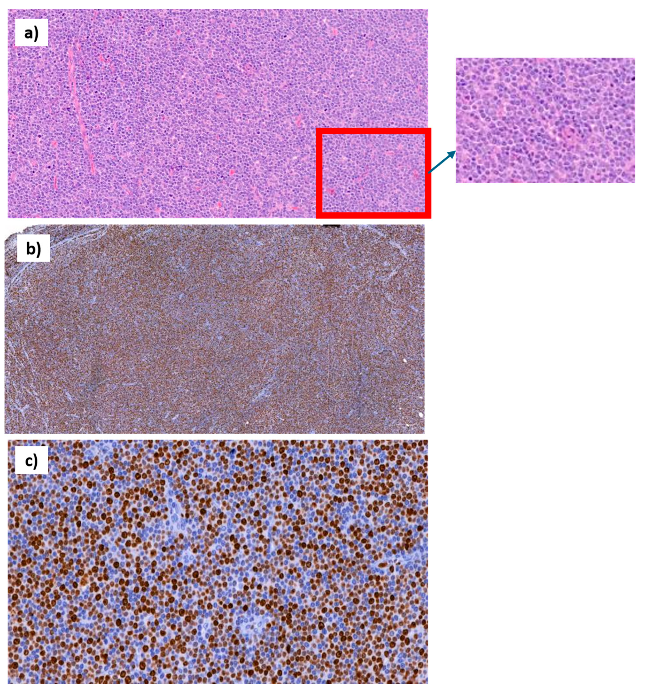 Hemato 05 00026 g006