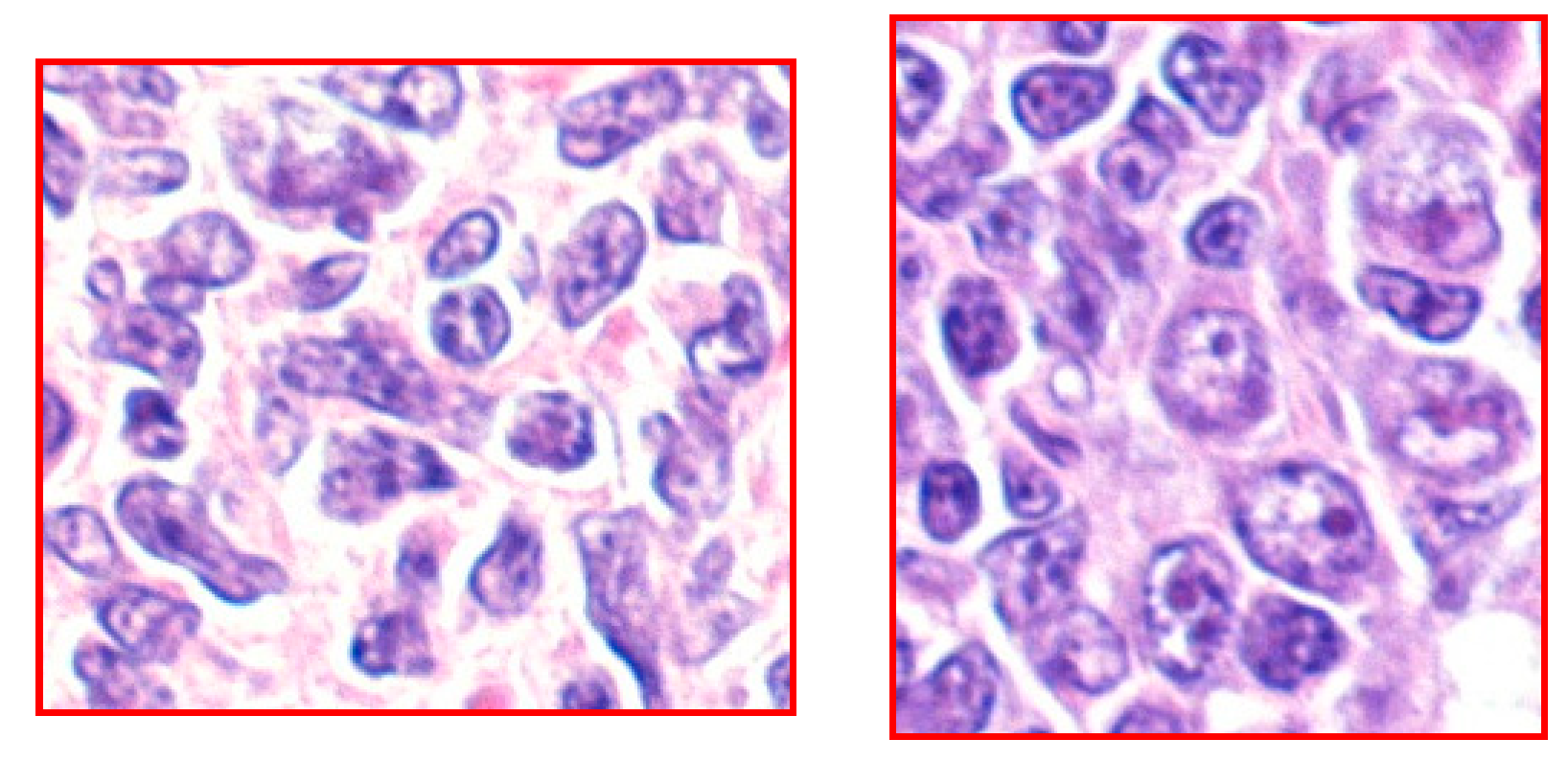 Hemato 05 00026 g008