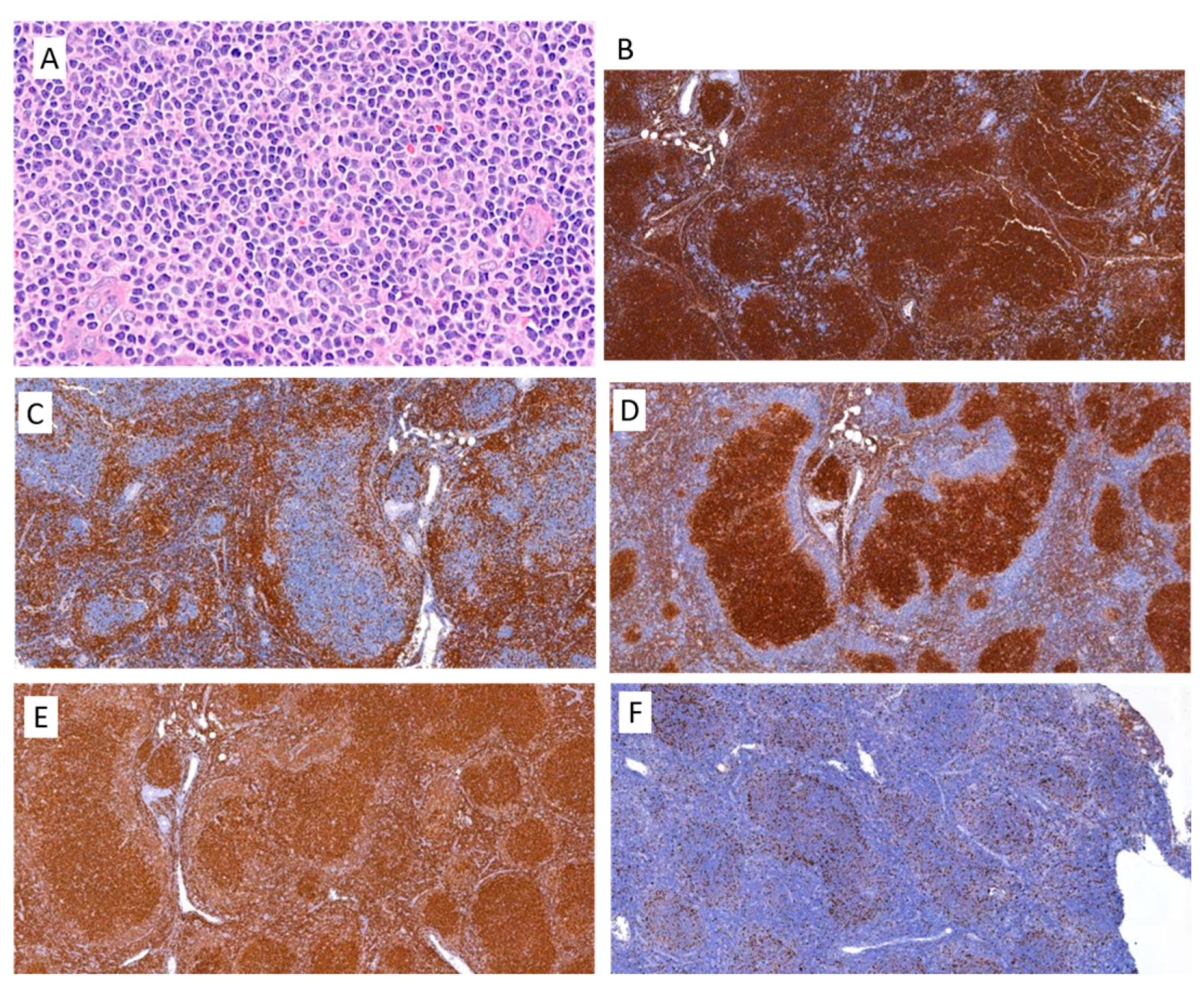 Hemato 05 00026 g009
