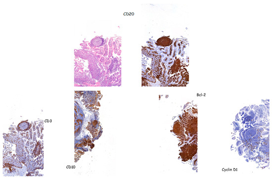 Hemato 05 00026 g010