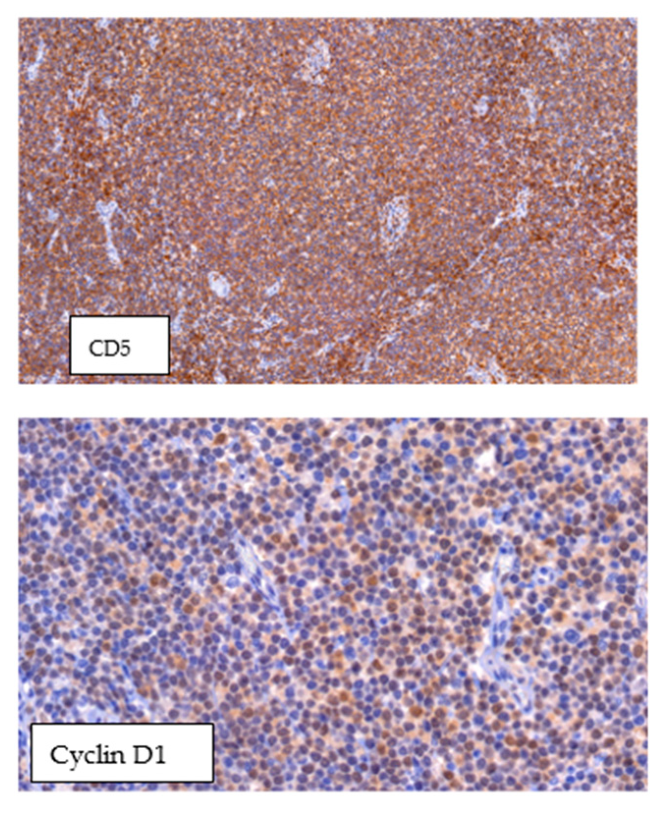 Hemato 05 00026 g011