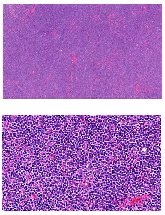 Hemato 05 00026 g013