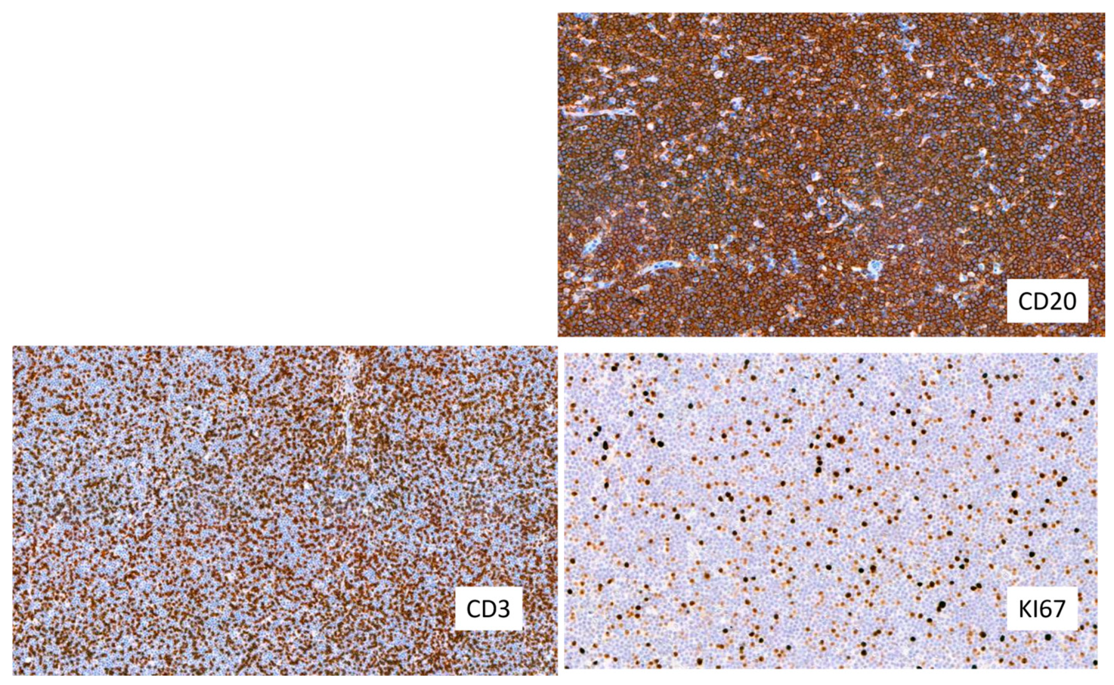 Hemato 05 00026 g014