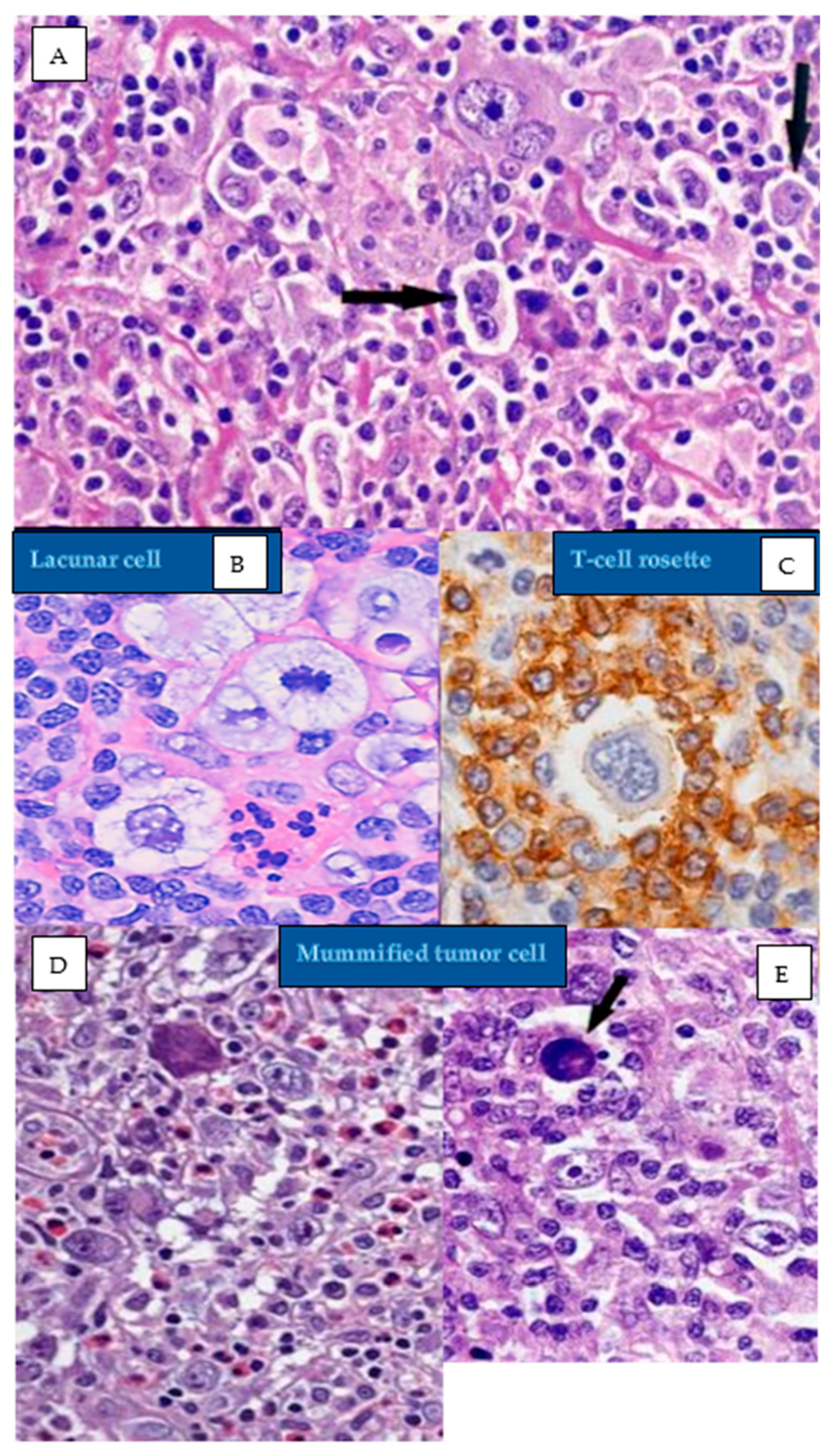 Hemato 05 00026 g015