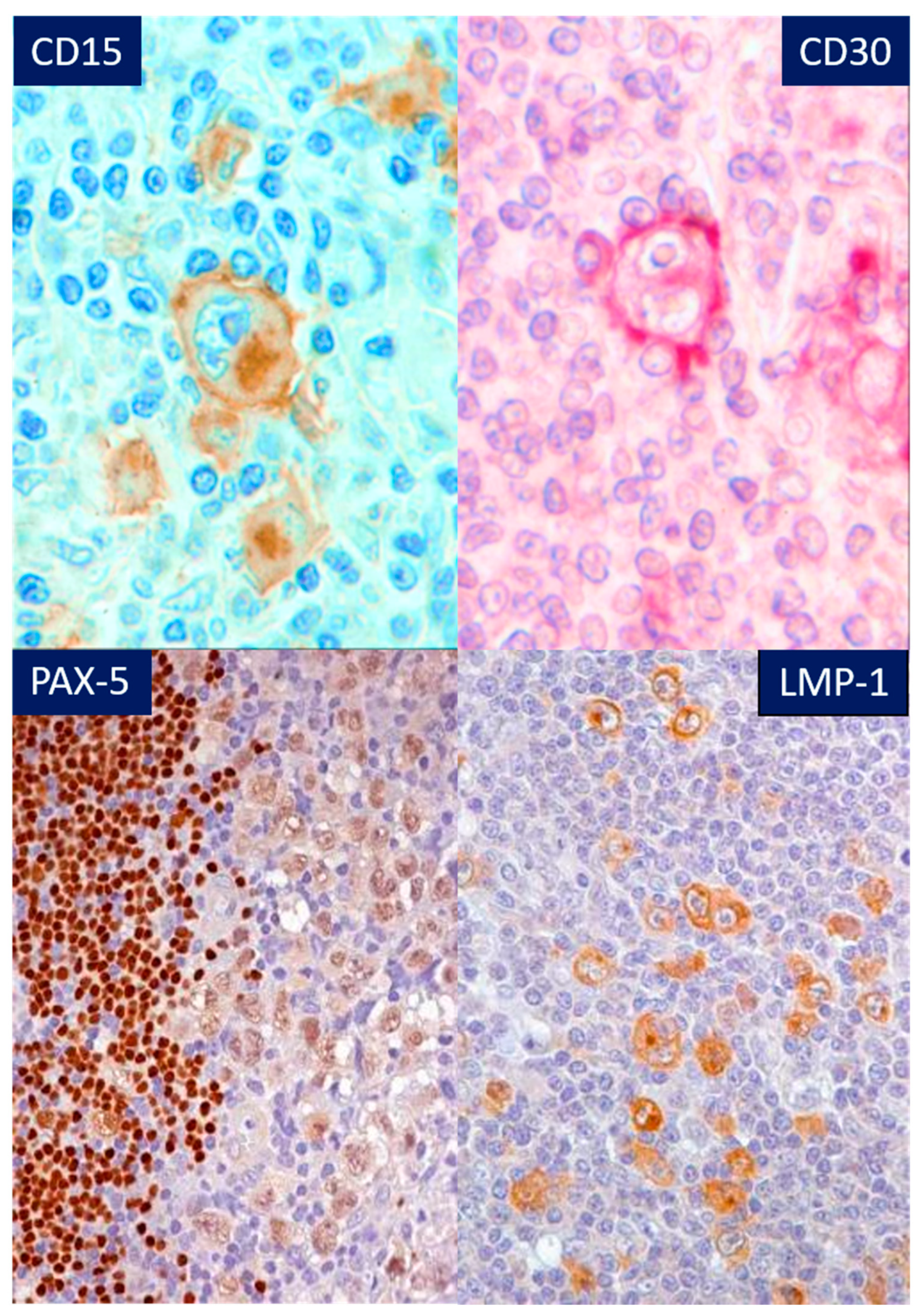 Hemato 05 00026 g016