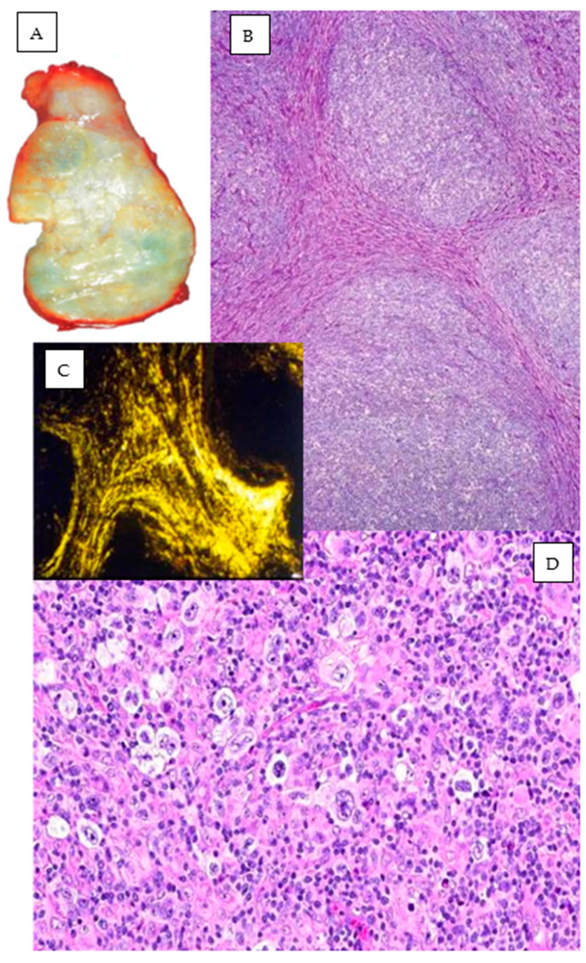 Hemato 05 00026 g017