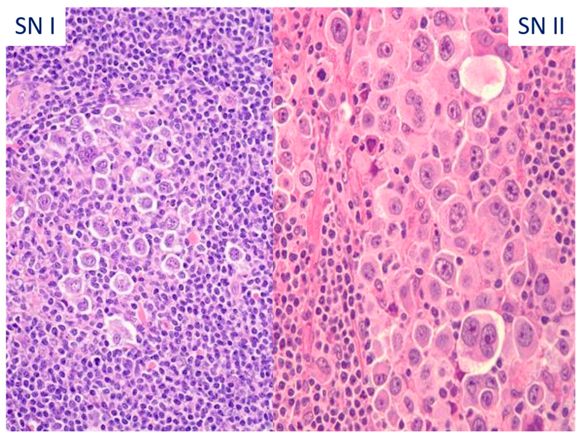 Hemato 05 00026 g018