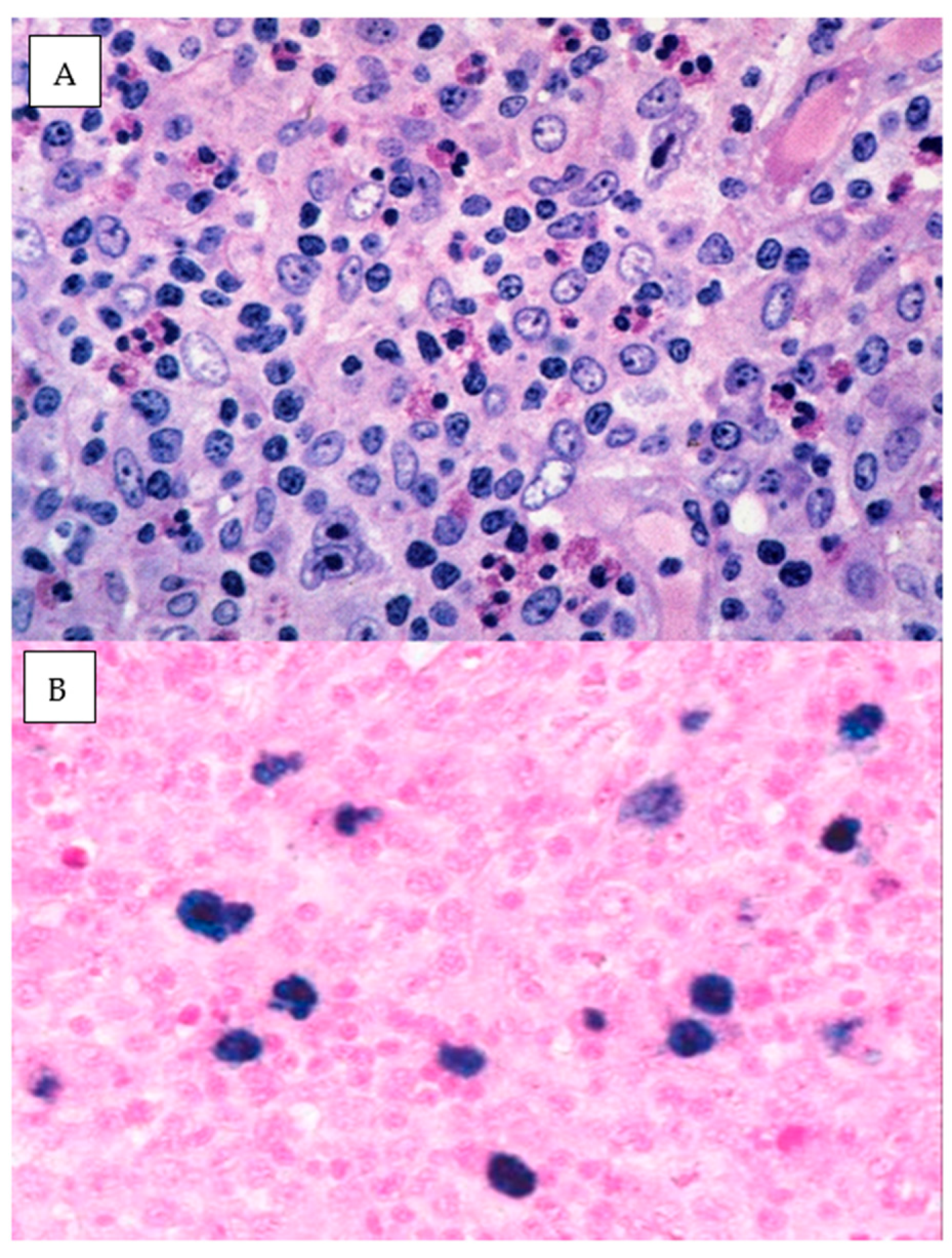 Hemato 05 00026 g019
