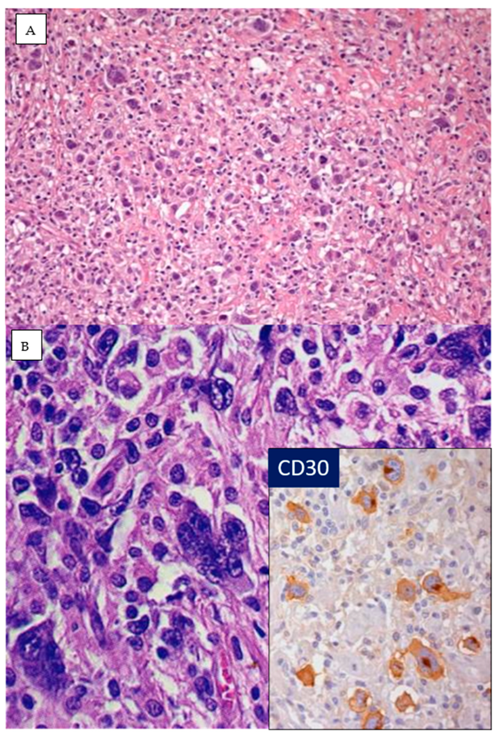 Hemato 05 00026 g021