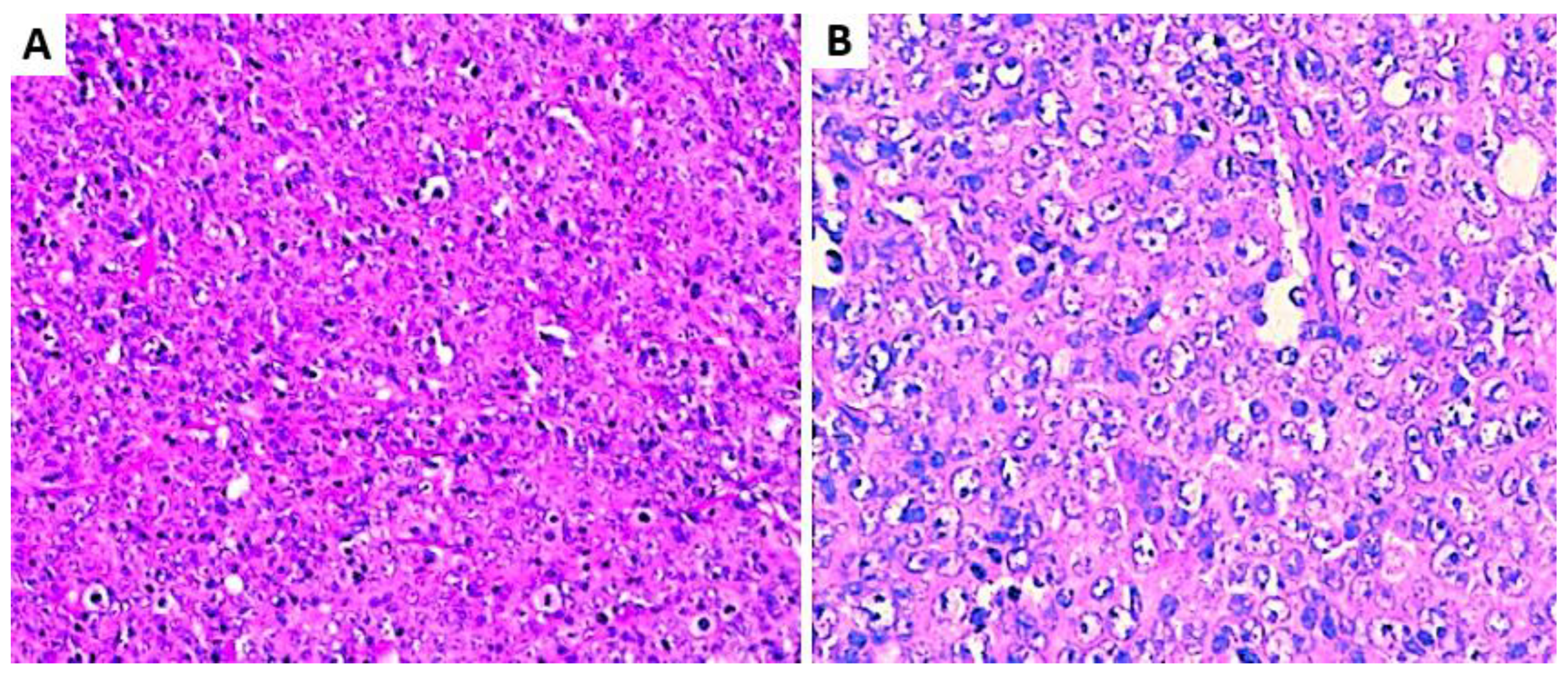 Hemato 05 00029 g001