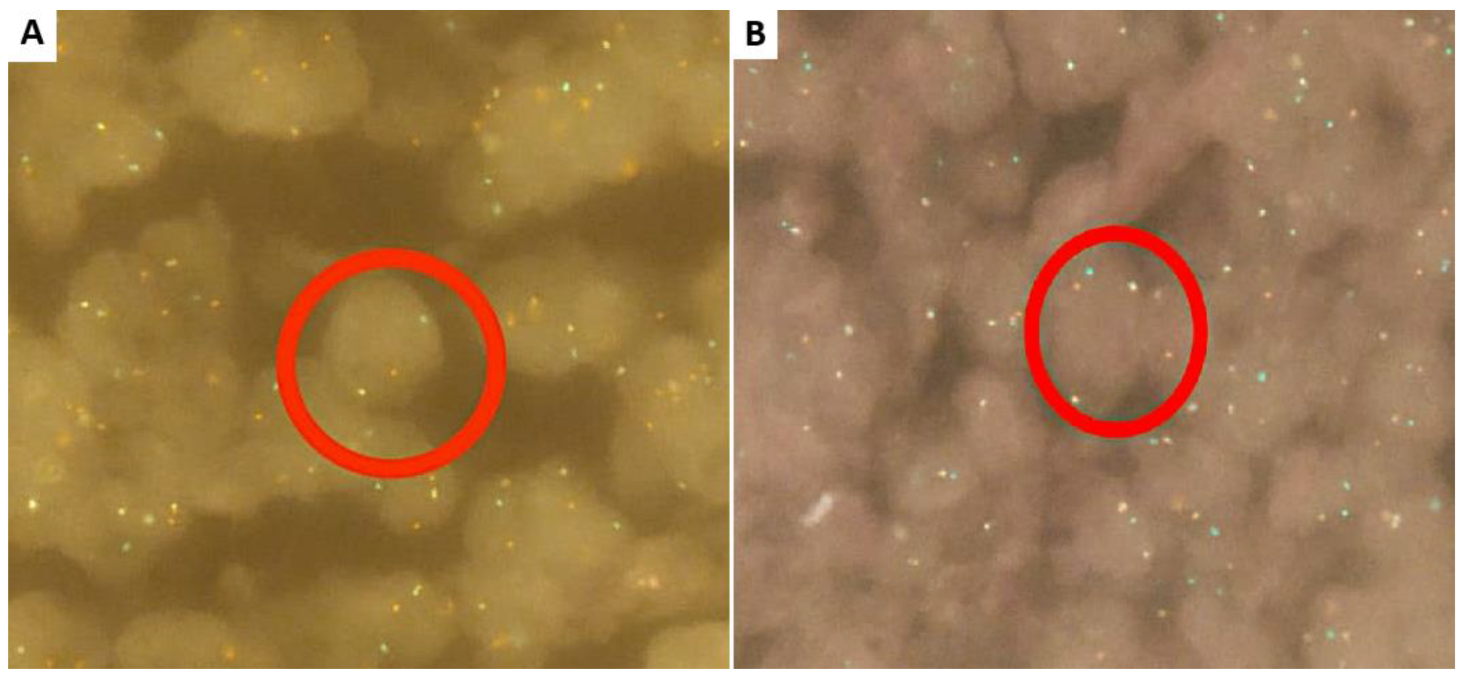 Hemato 05 00029 g003