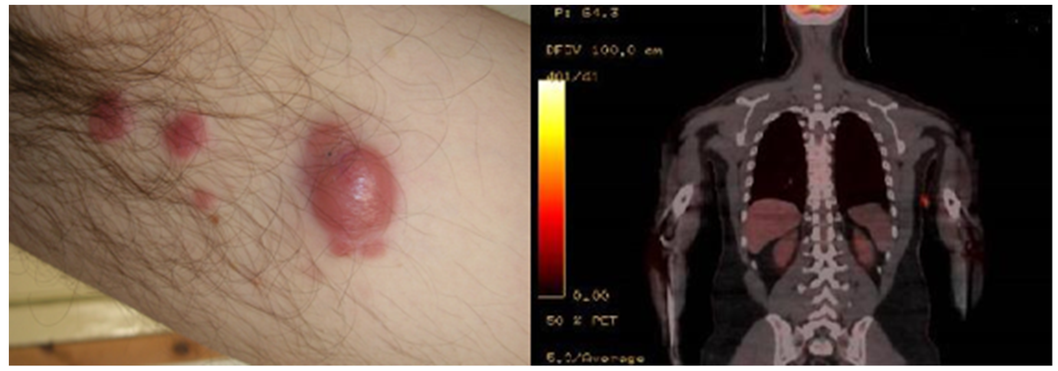 Hematolrep 14 00010 g001