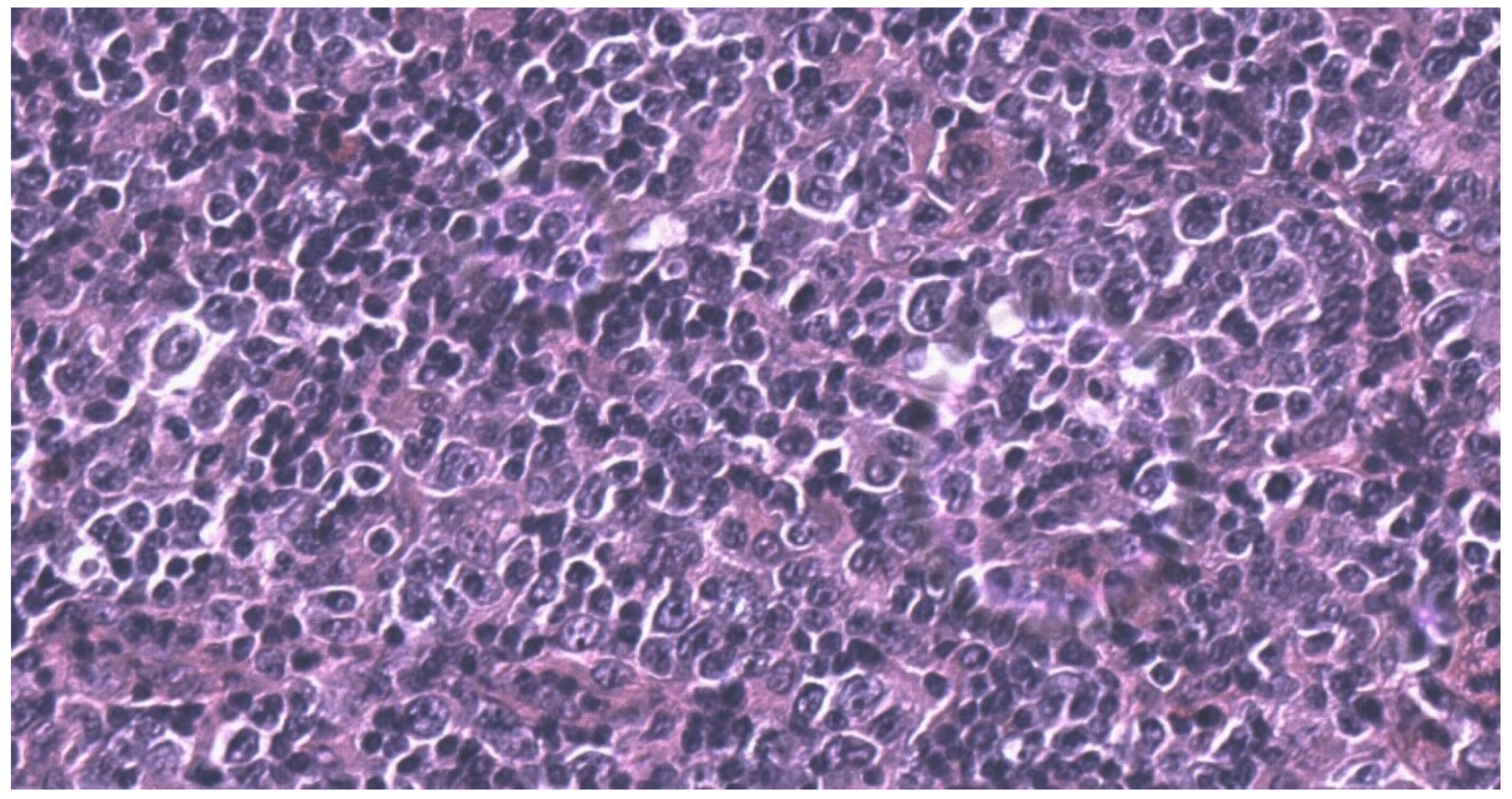 Hematolrep 14 00010 g002