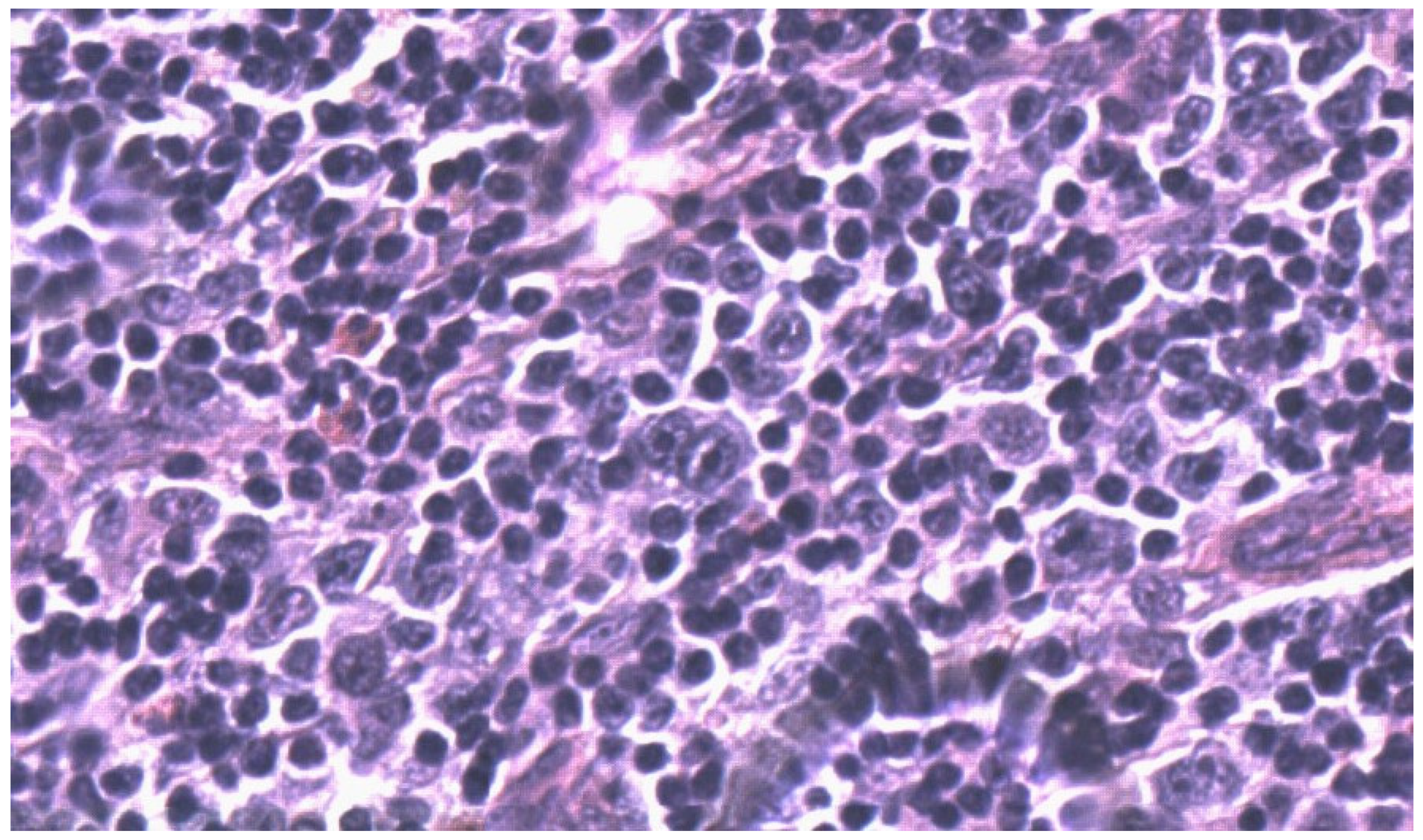 Hematolrep 14 00010 g003