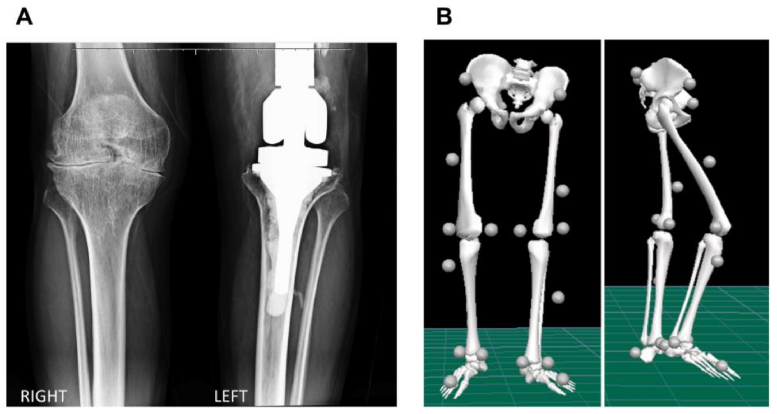 Hematolrep 14 00017 g001
