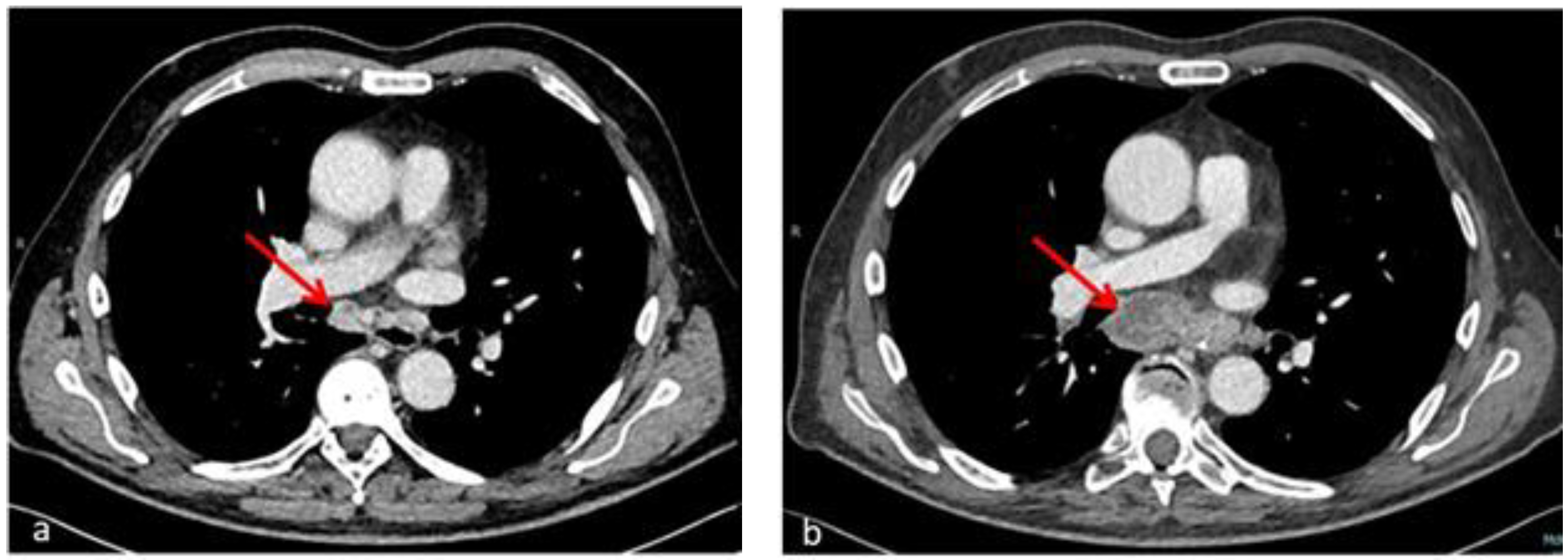 Hematolrep 14 00020 g002