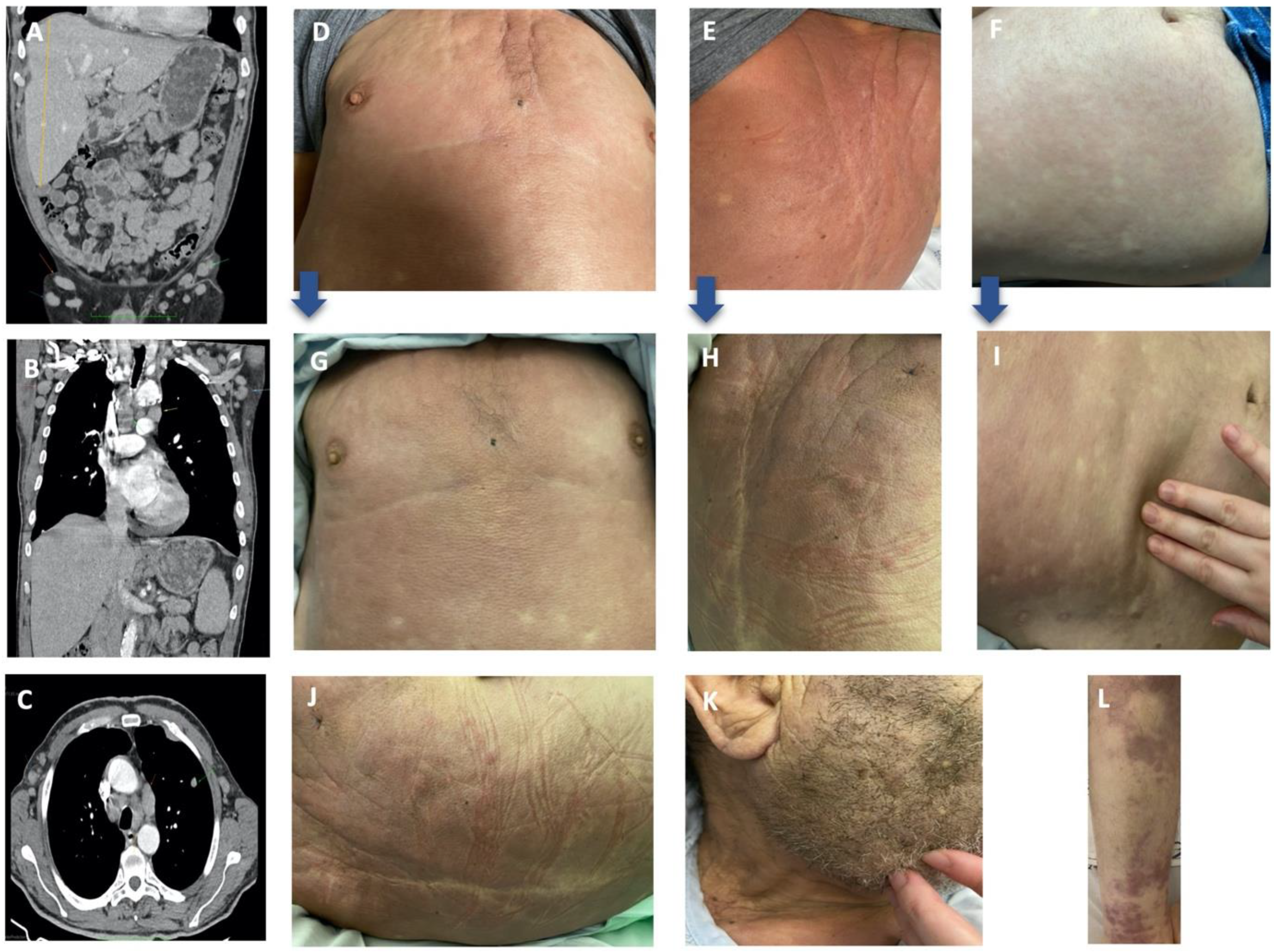 Hematolrep 14 00021 g001