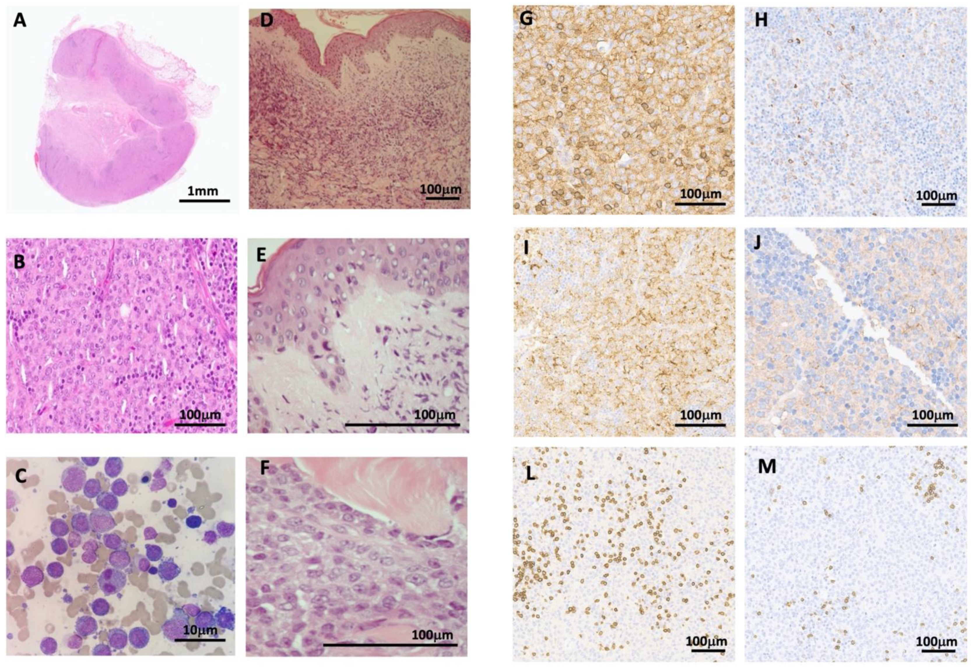 Hematolrep 14 00021 g002