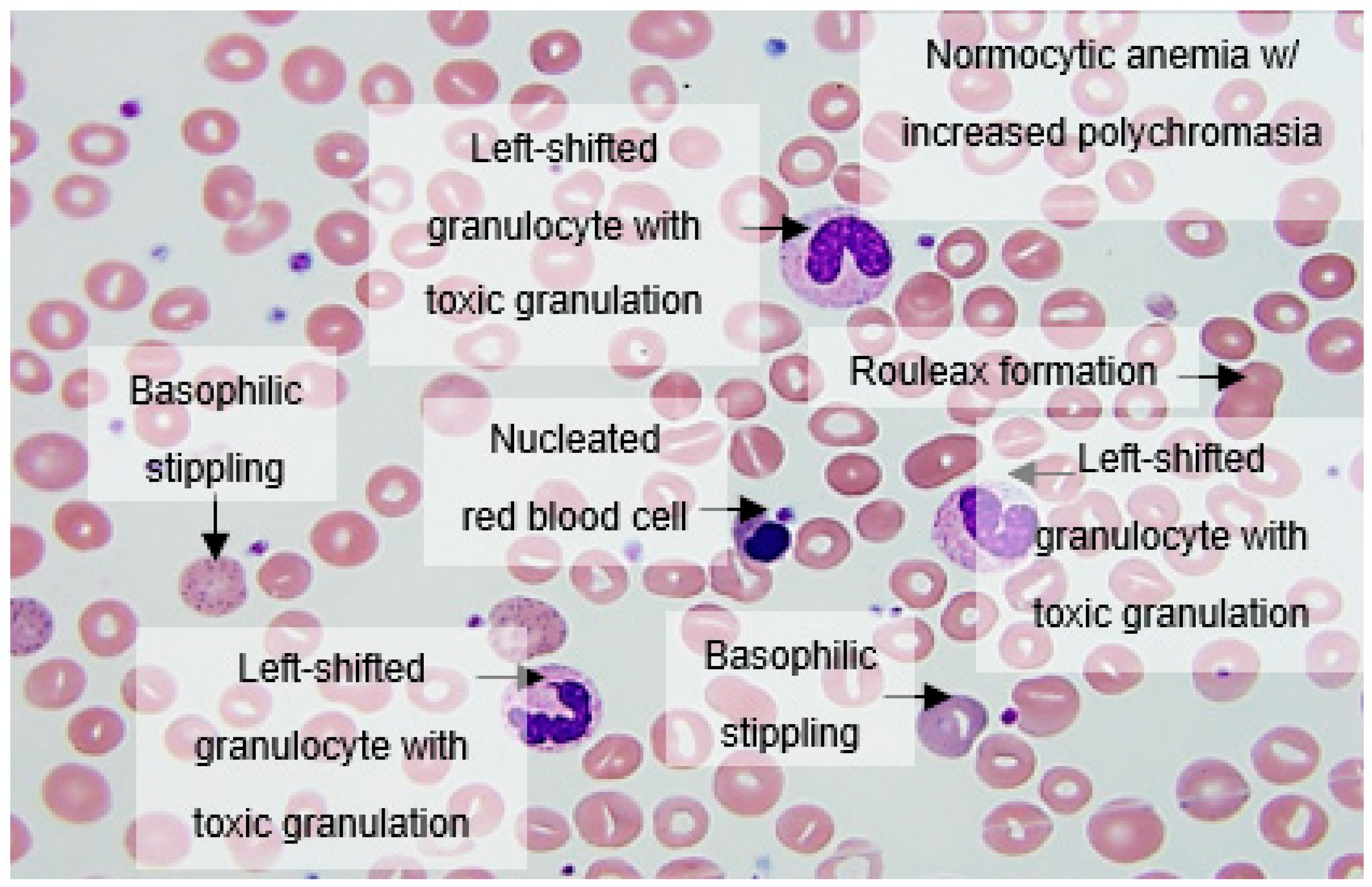 Hematolrep 14 00031 g001