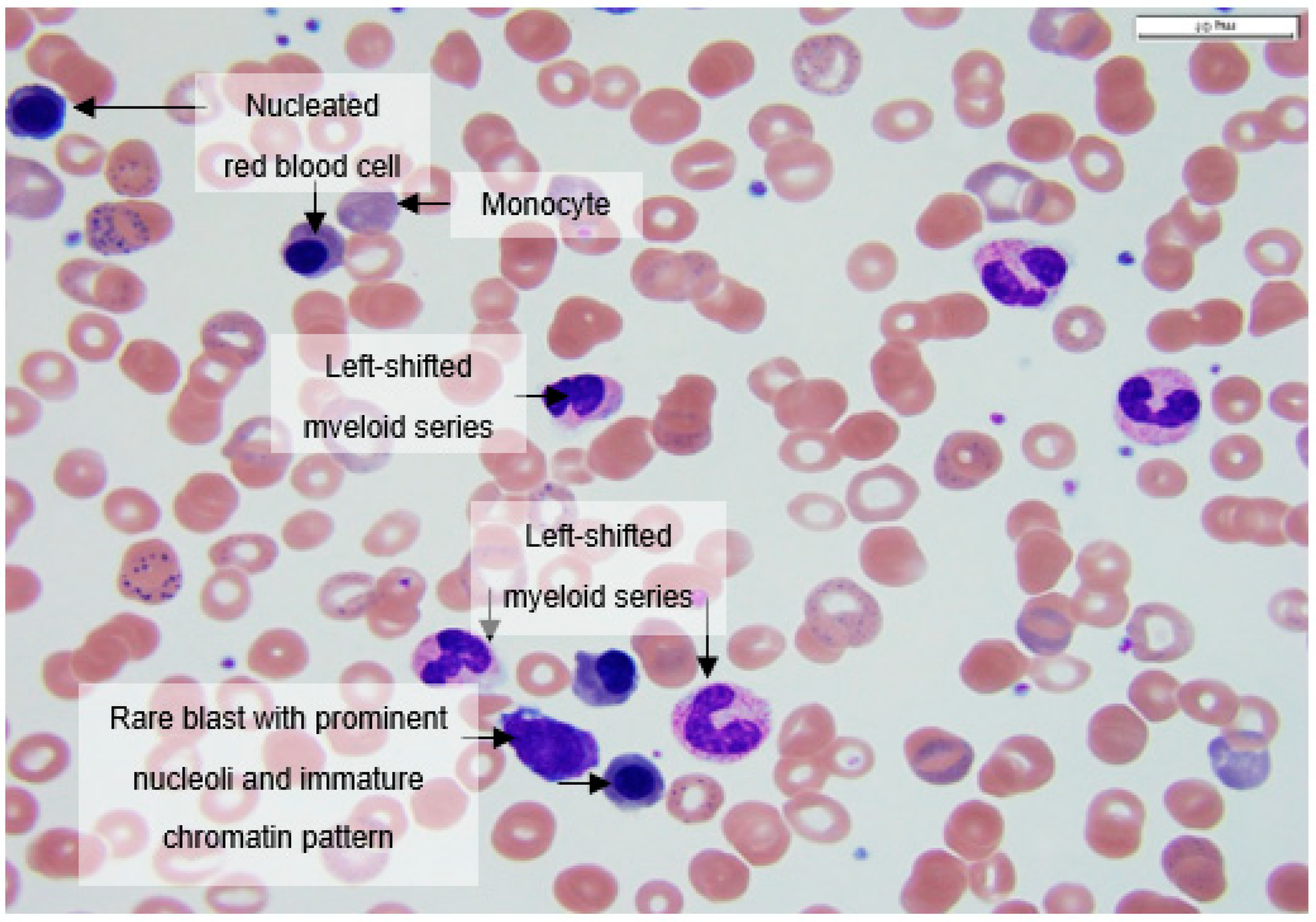Hematolrep 14 00031 g002