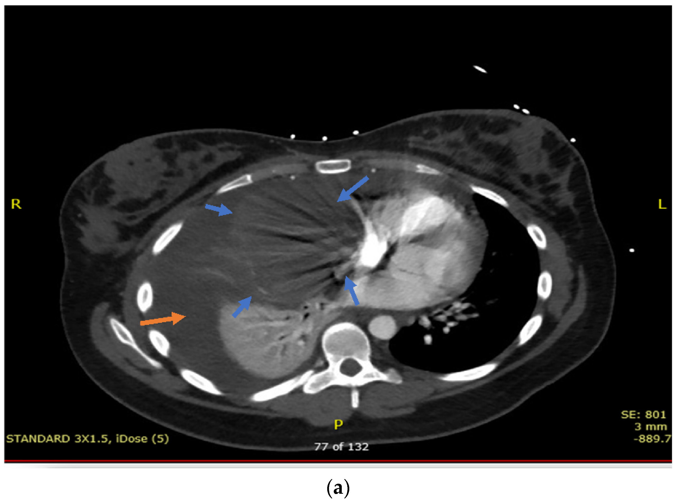 Hematolrep 14 00046 g001a