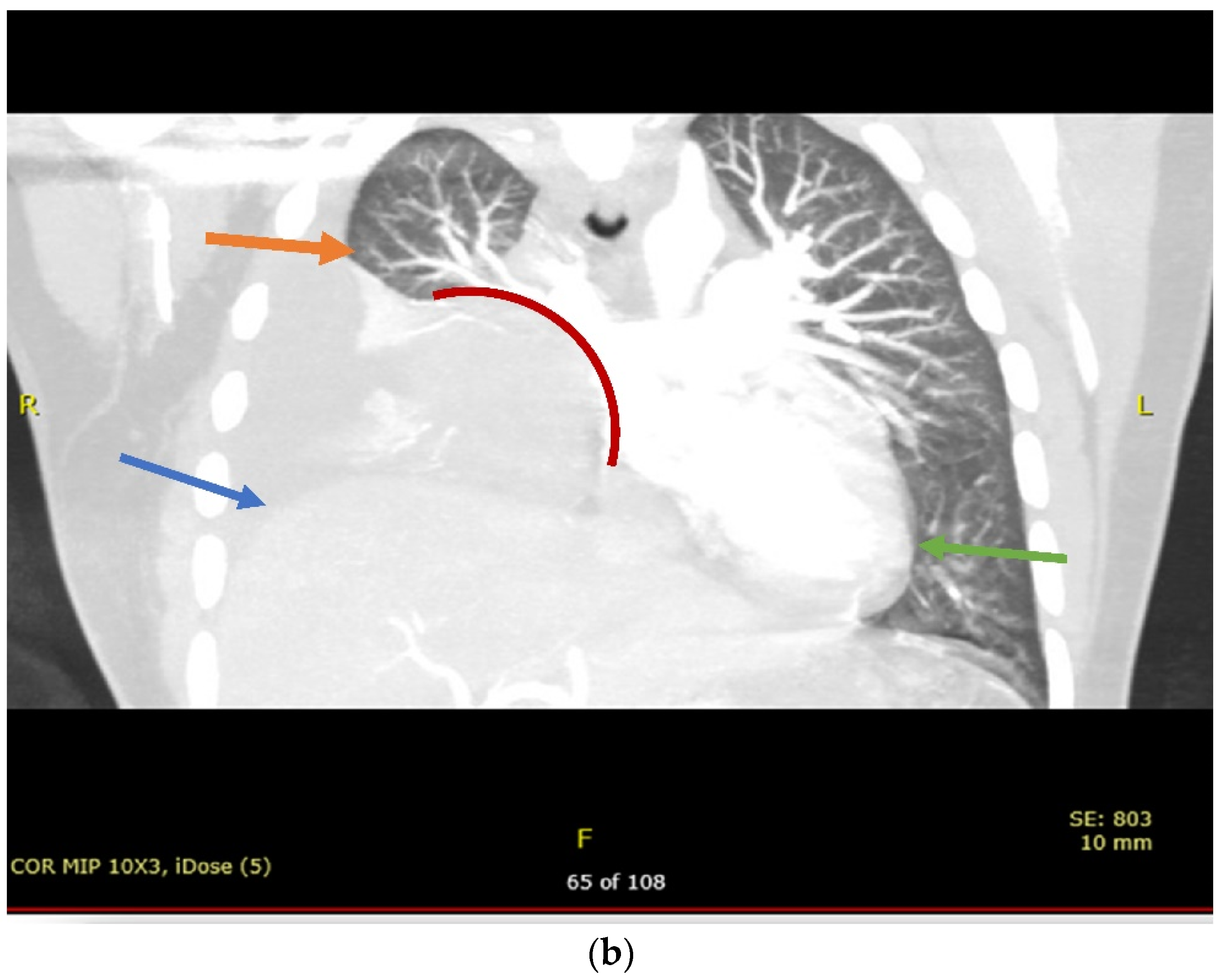 Hematolrep 14 00046 g001b