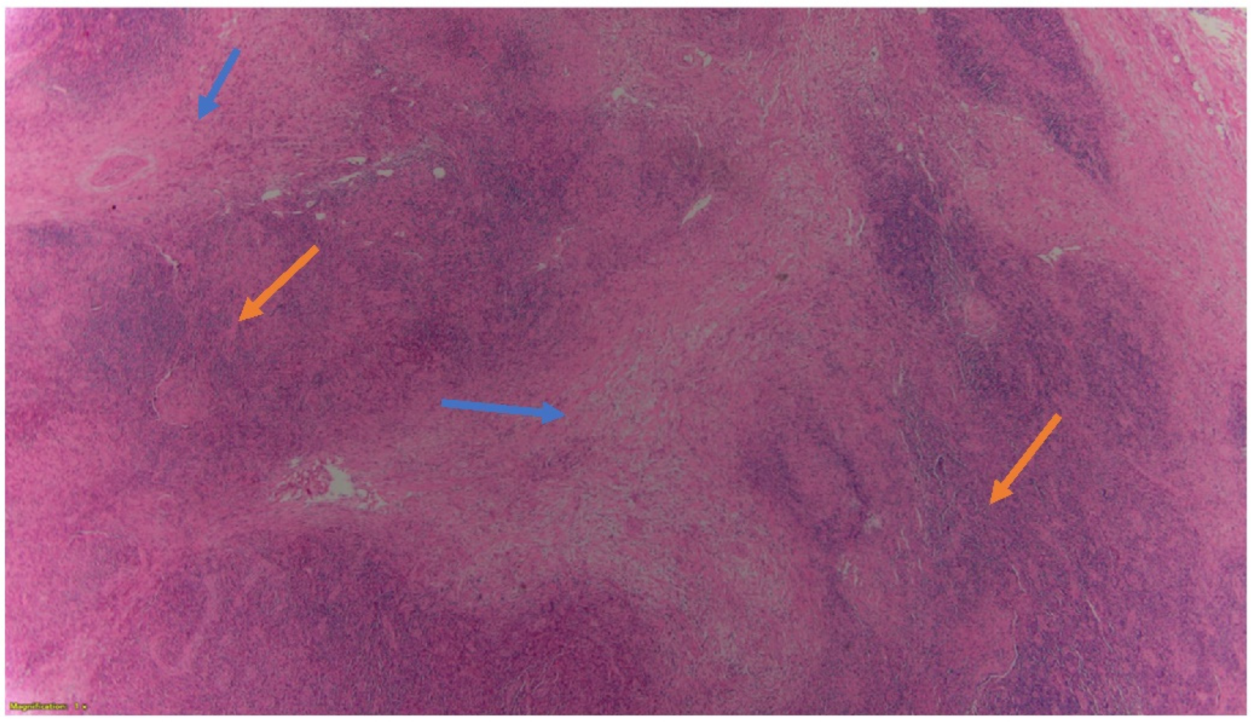 Hematolrep 14 00046 g002