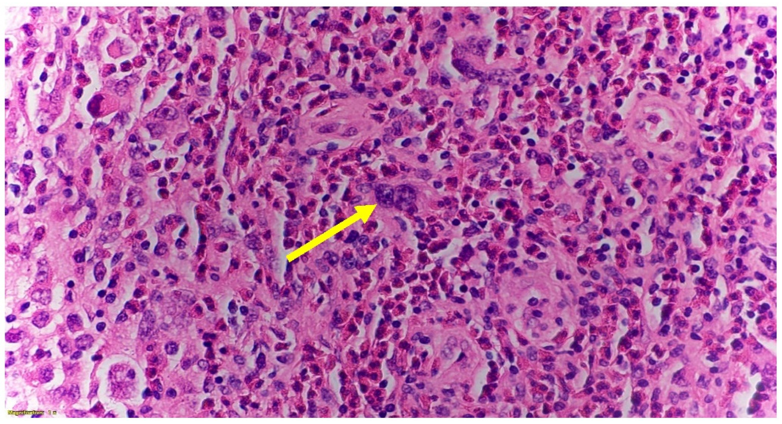 Hematolrep 14 00046 g003