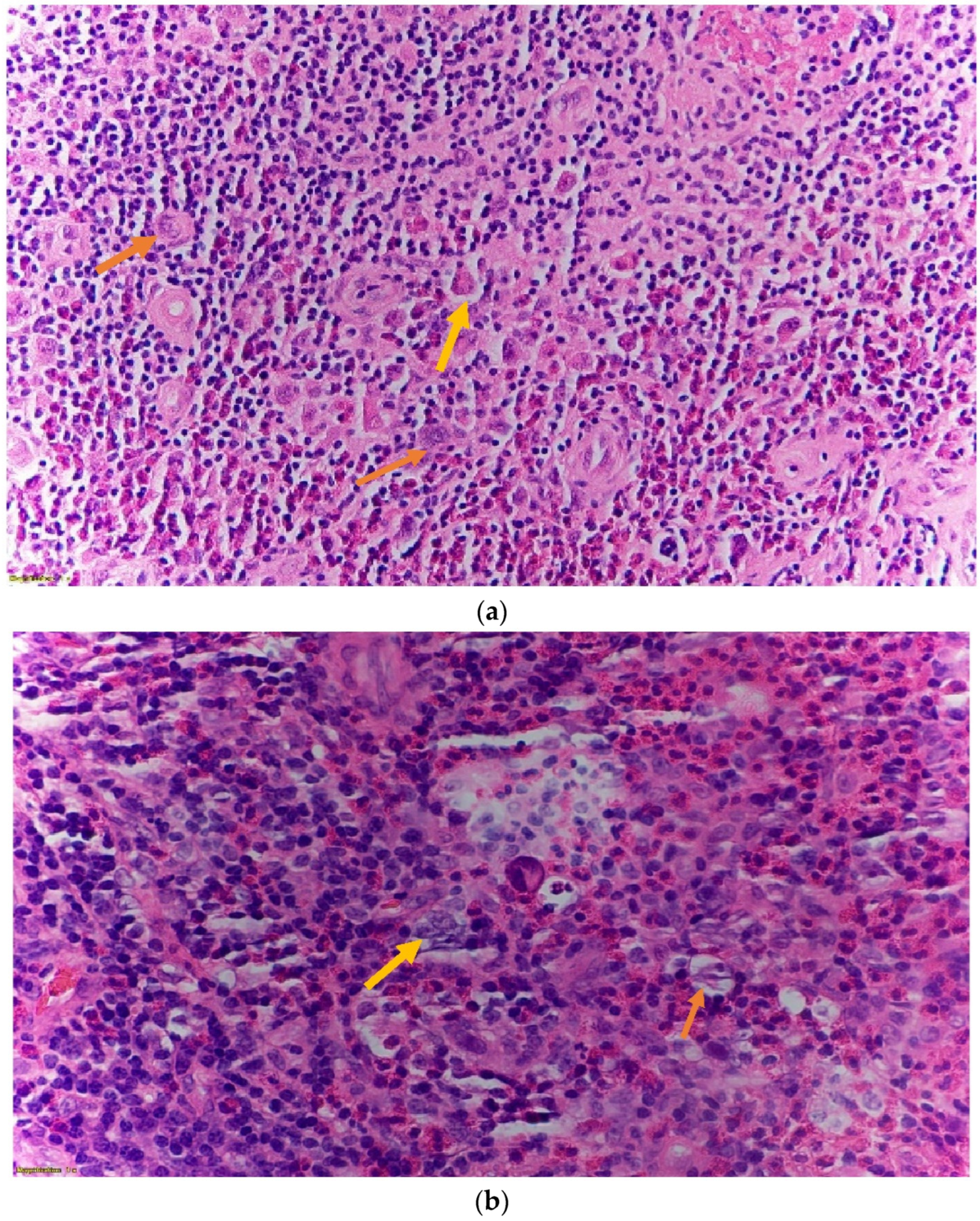 Hematolrep 14 00046 g004