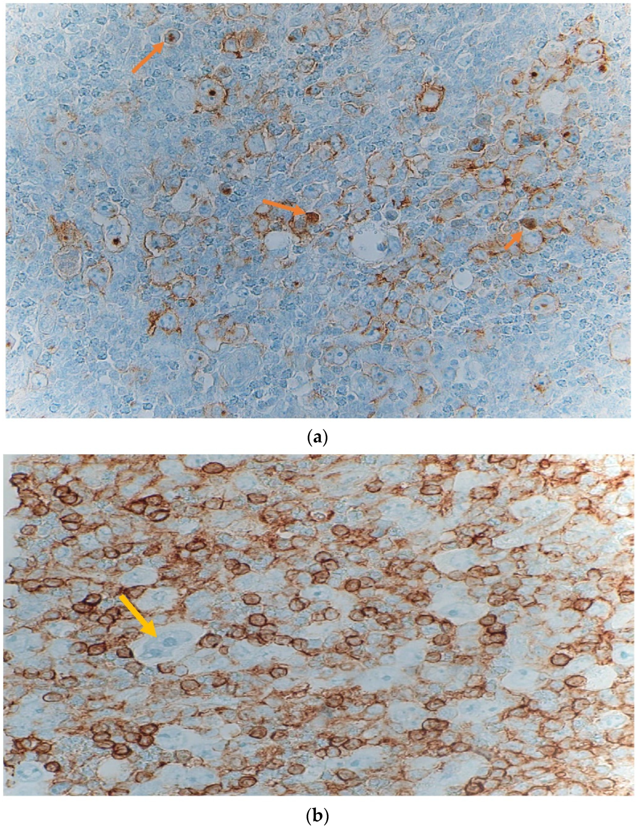 Hematolrep 14 00046 g005