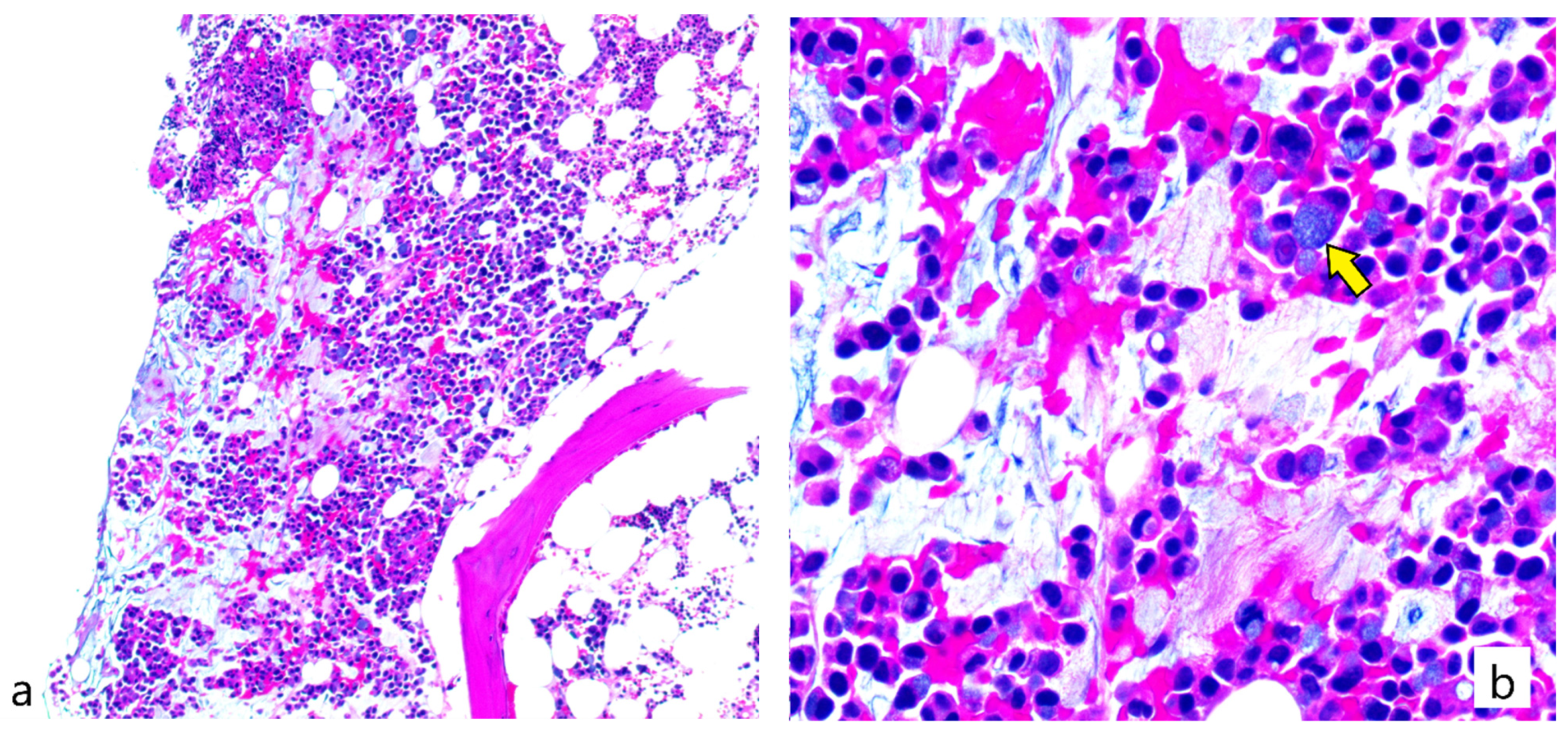 Hematolrep 15 00002 g001 Hematolrep 15 00002 g001