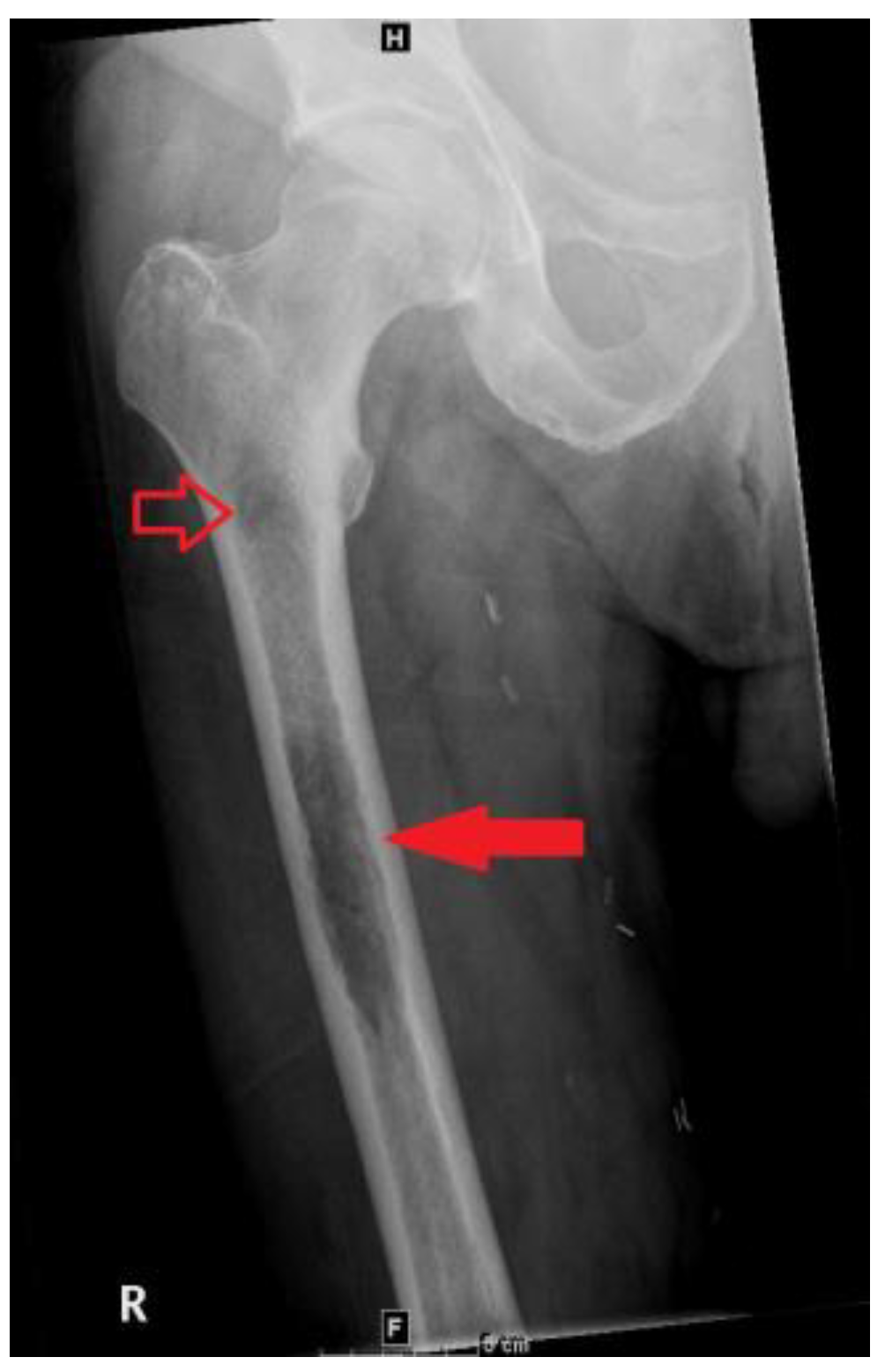 Hematolrep 15 00007 g002 Hematolrep 15 00007 g002