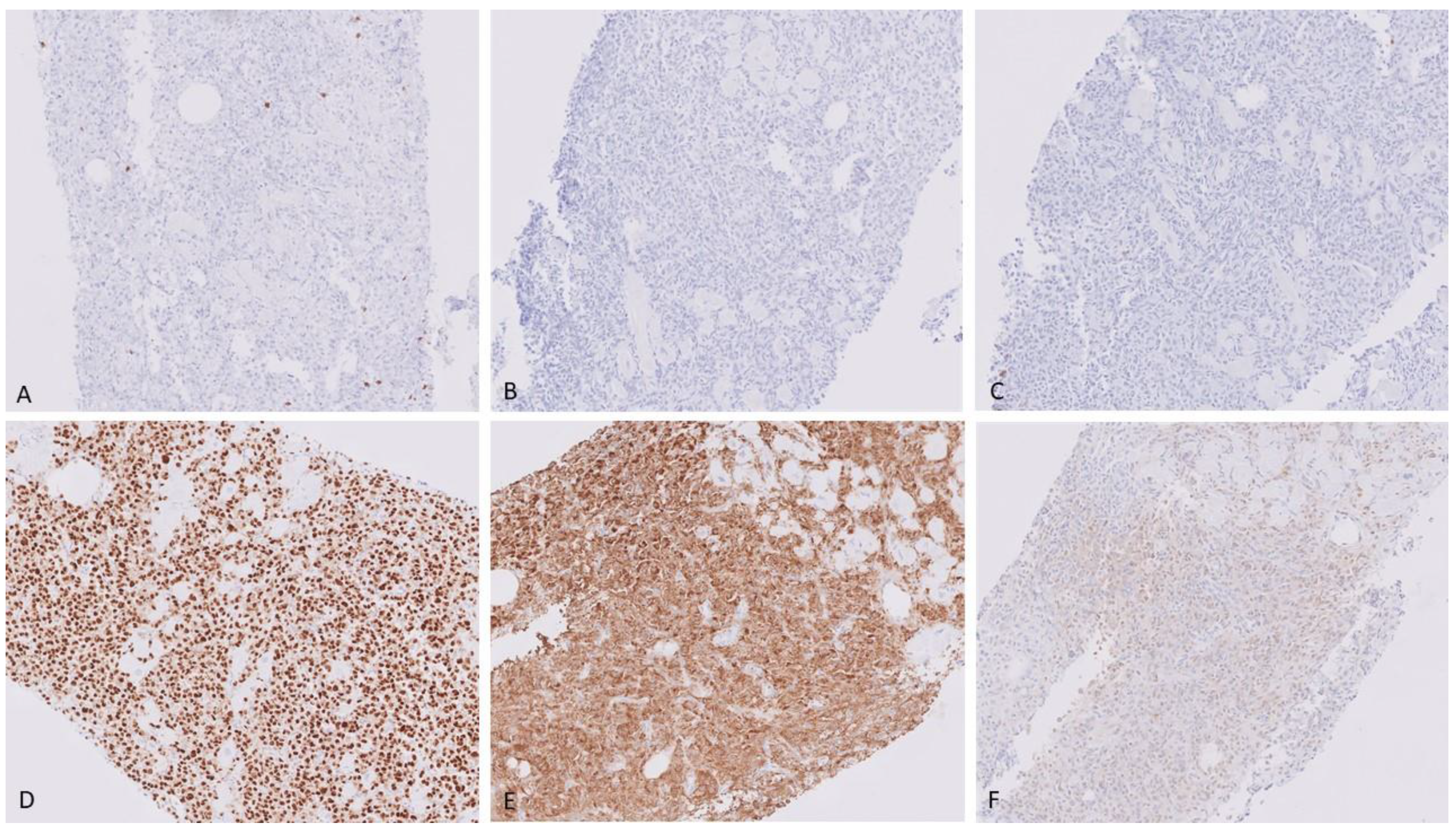 Hematolrep 15 00007 g005 Hematolrep 15 00007 g005