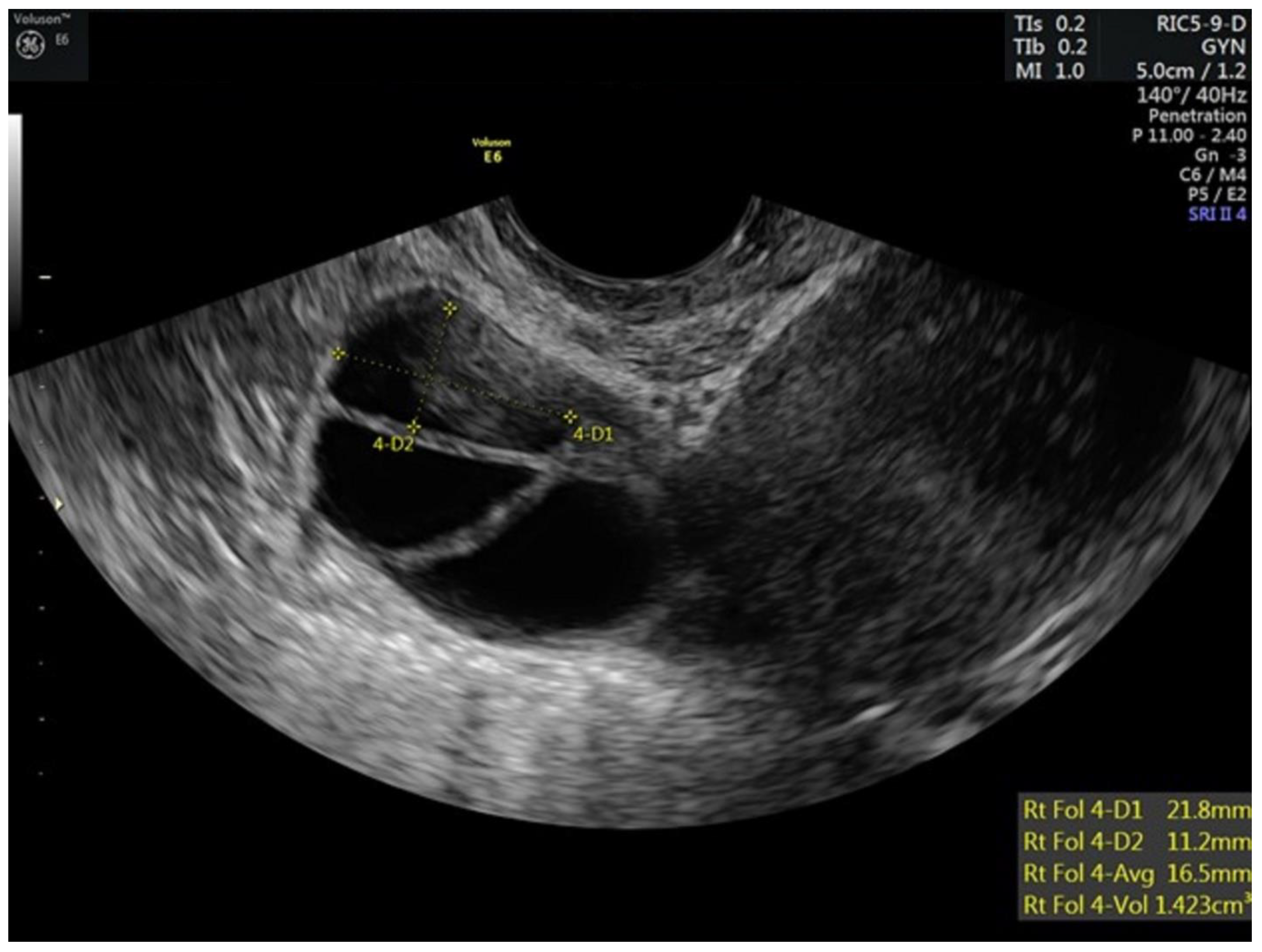 Hematolrep 15 00011 g001