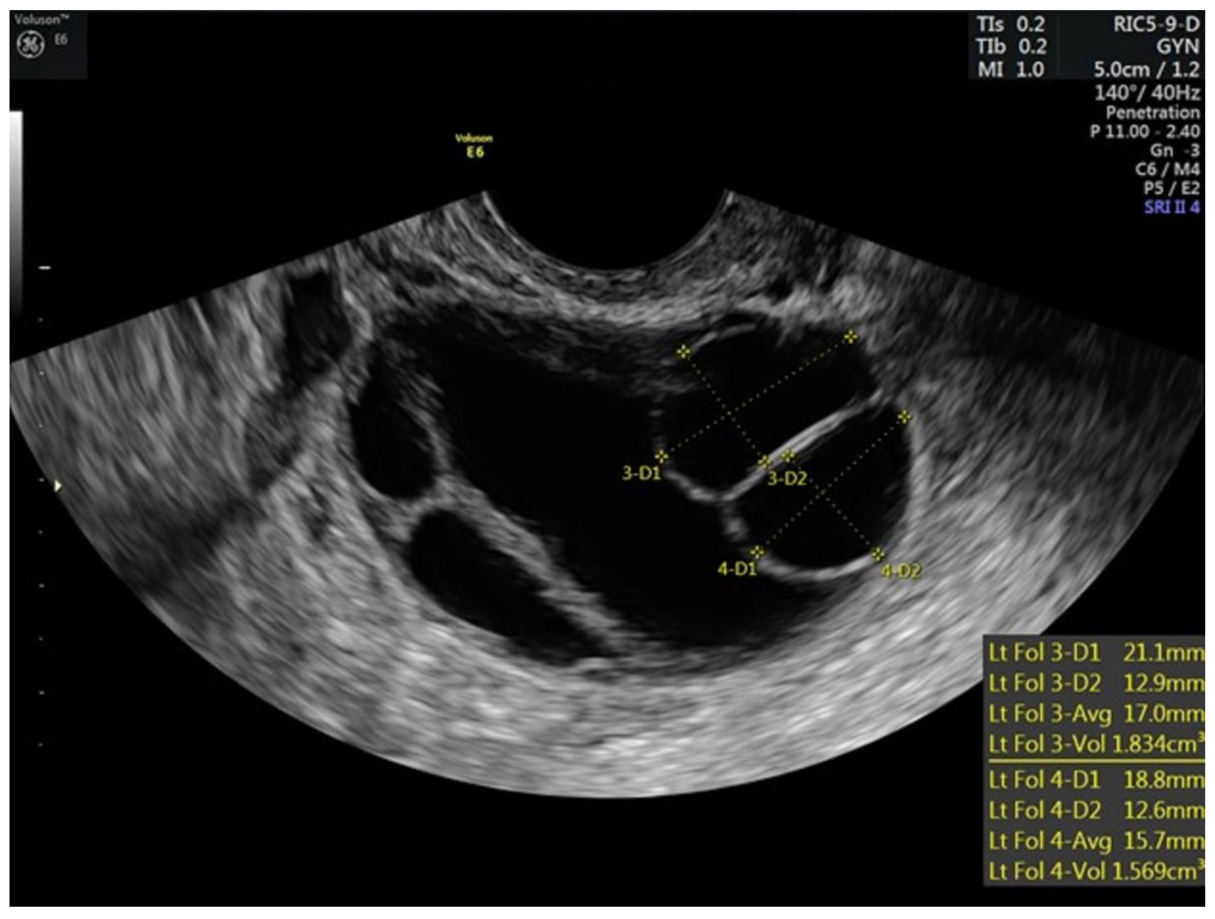 Hematolrep 15 00011 g002