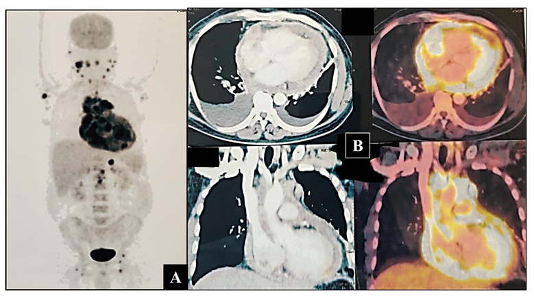 Hematolrep 15 00017 g002
