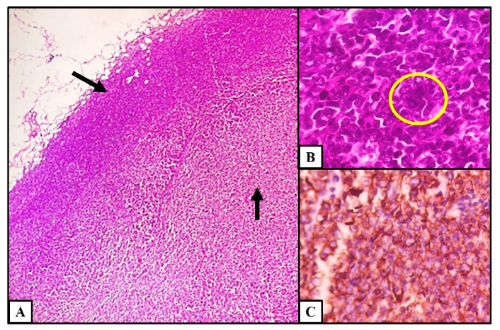 Hematolrep 15 00017 g003
