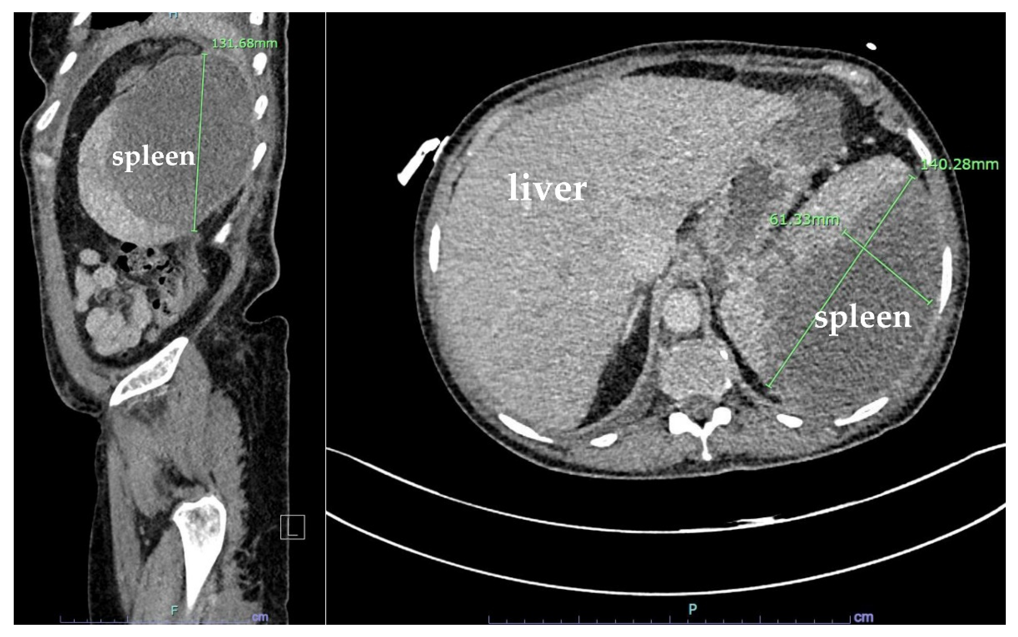 Hematolrep 15 00038 g005
