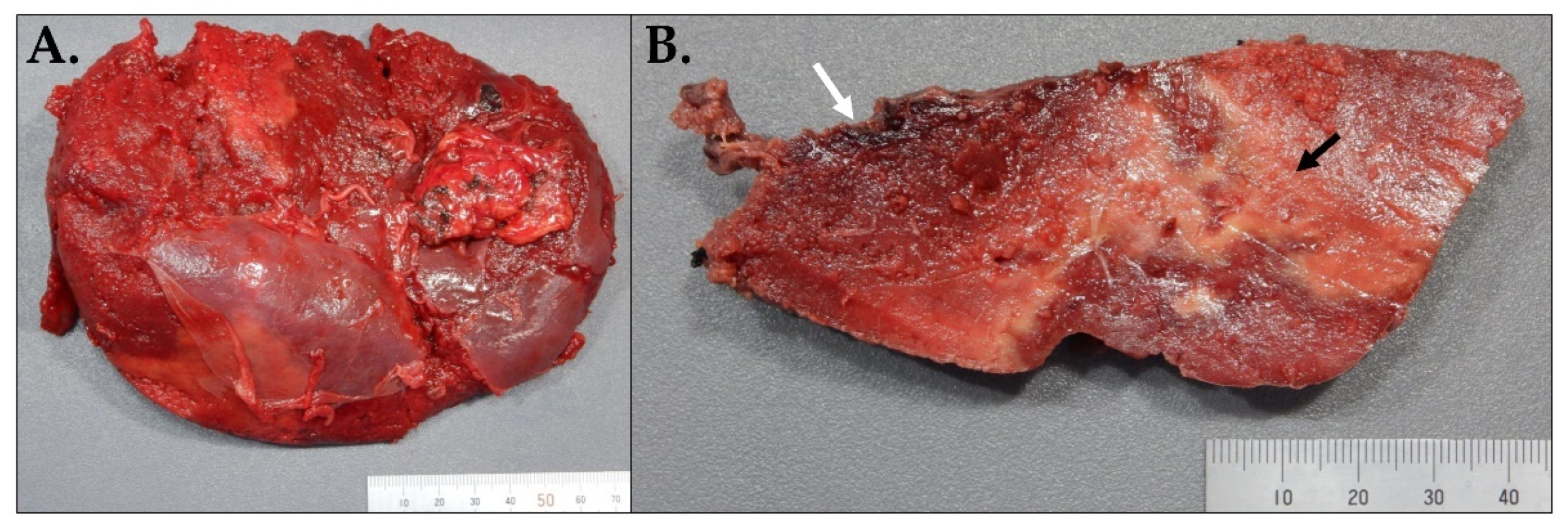 Hematolrep 15 00038 g006