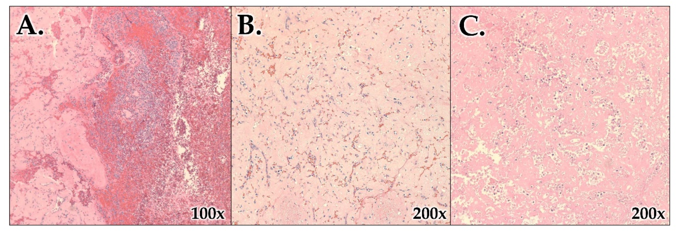 Hematolrep 15 00038 g007