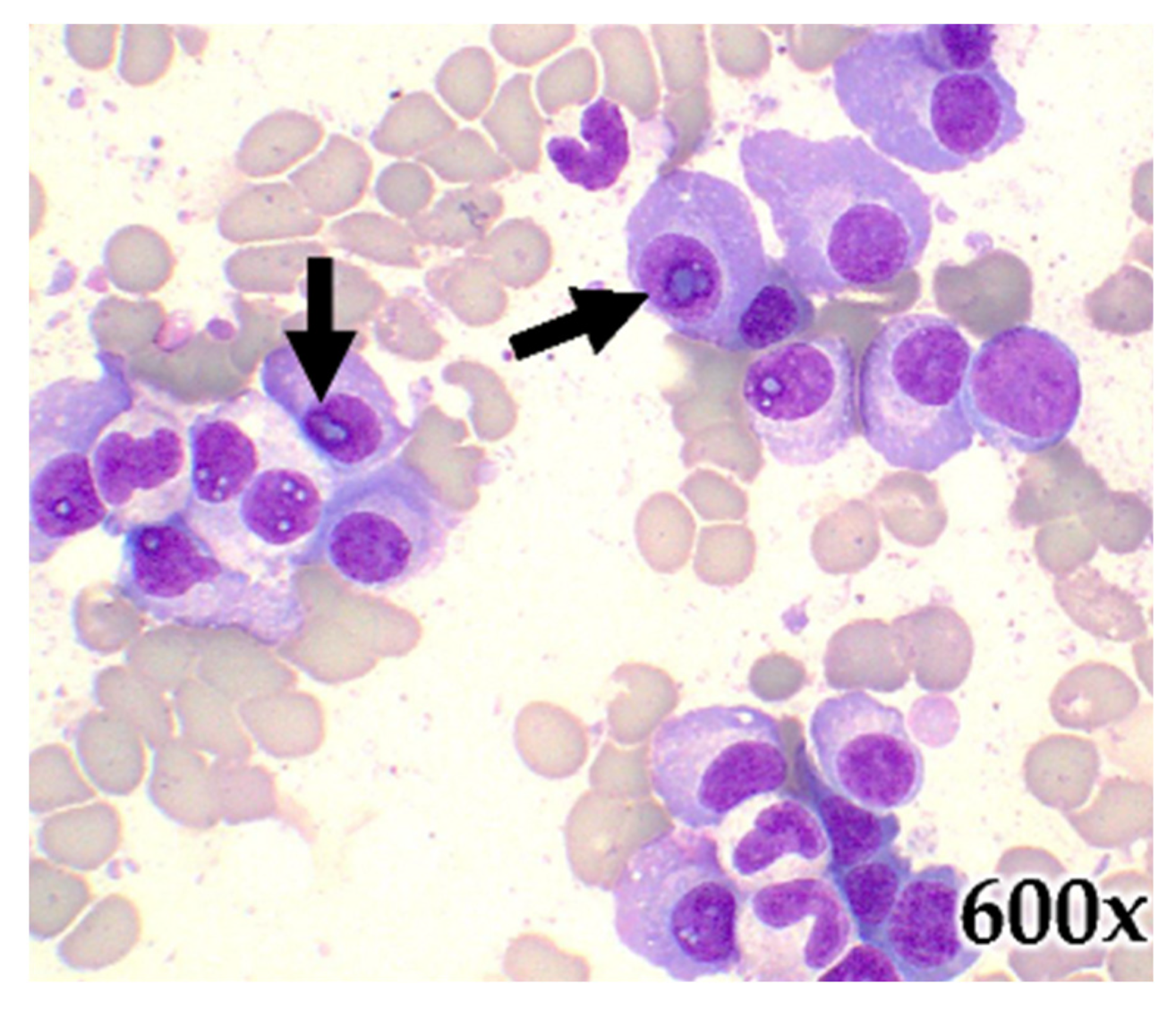 Hematolrep 15 00038 g008