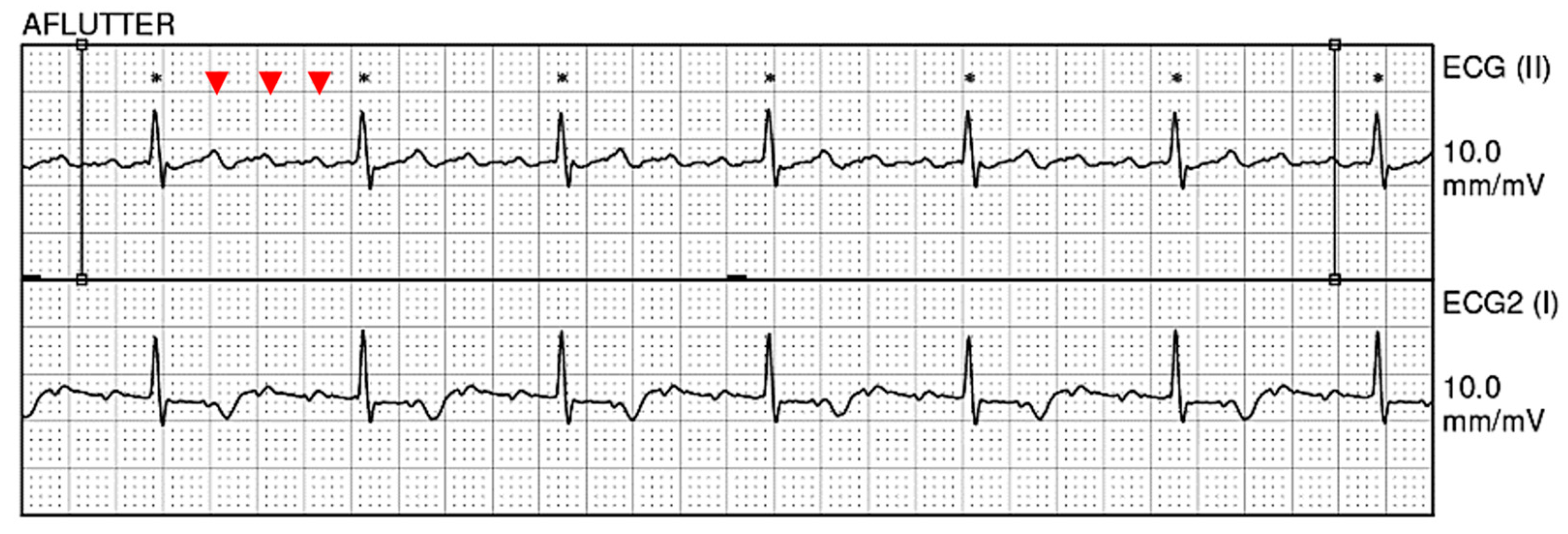 Hematolrep 15 00042 g001