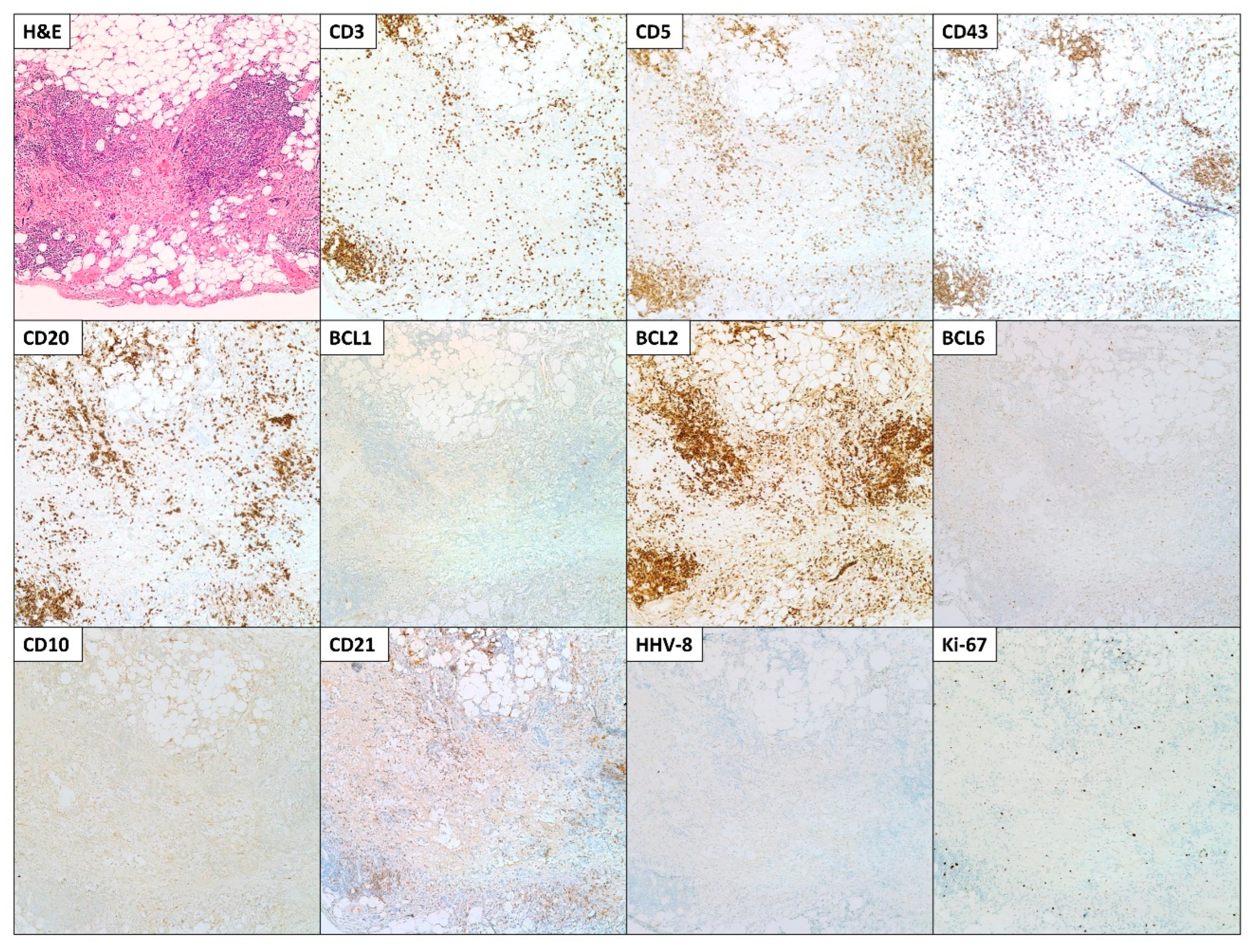 Hematolrep 15 00042 g004