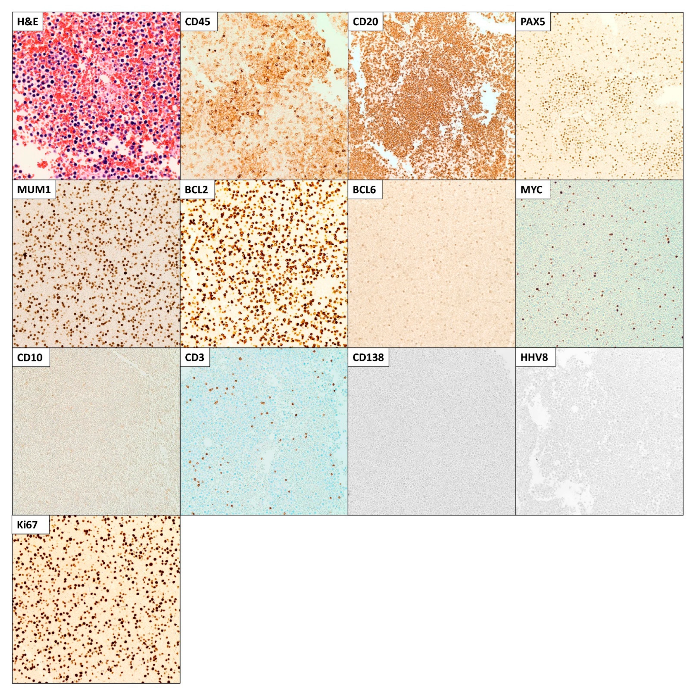 Hematolrep 15 00042 g005