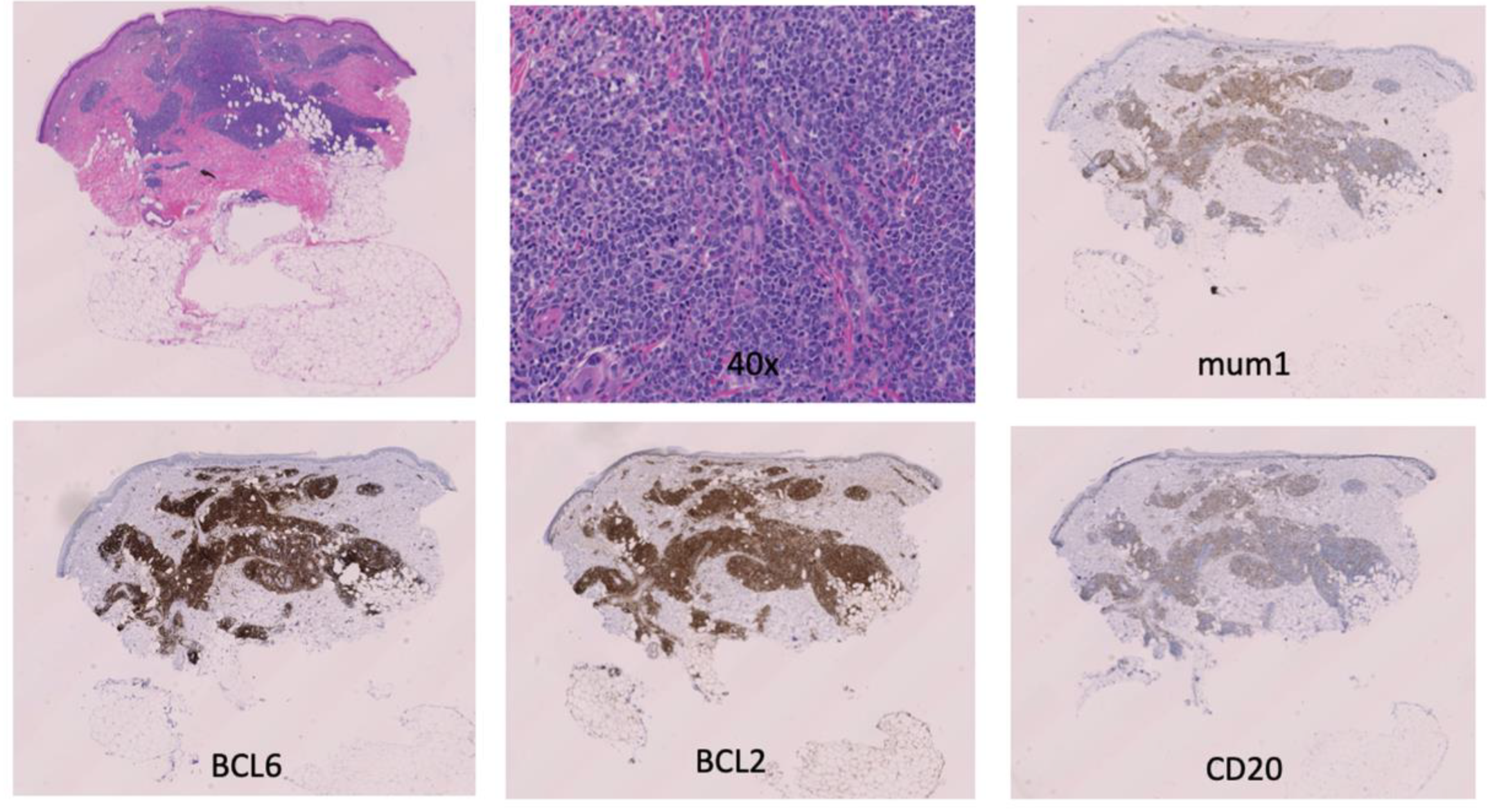 Hematolrep 15 00053 g002