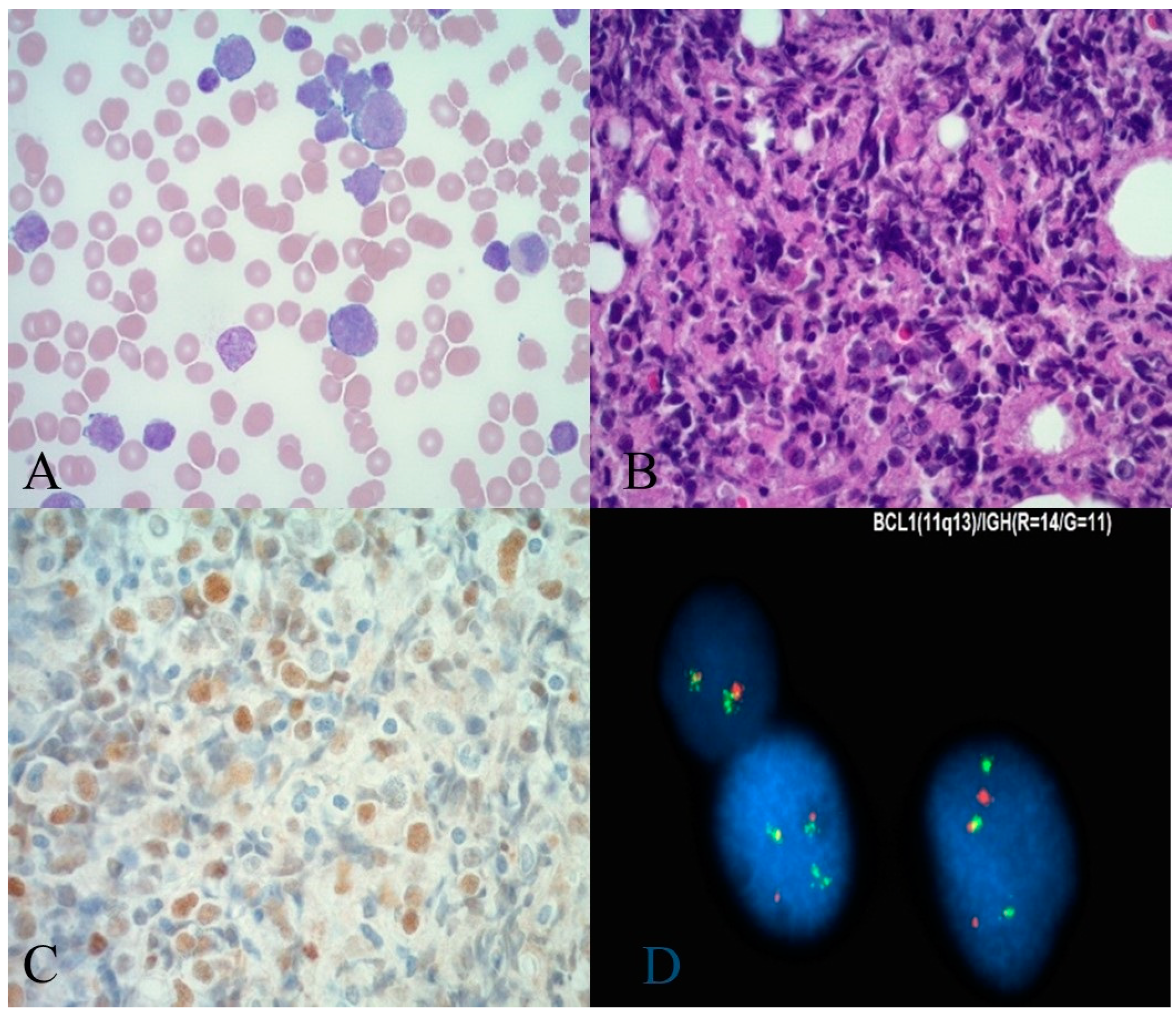Hematolrep 15 00061 g001 Hematolrep 15 00061 g001