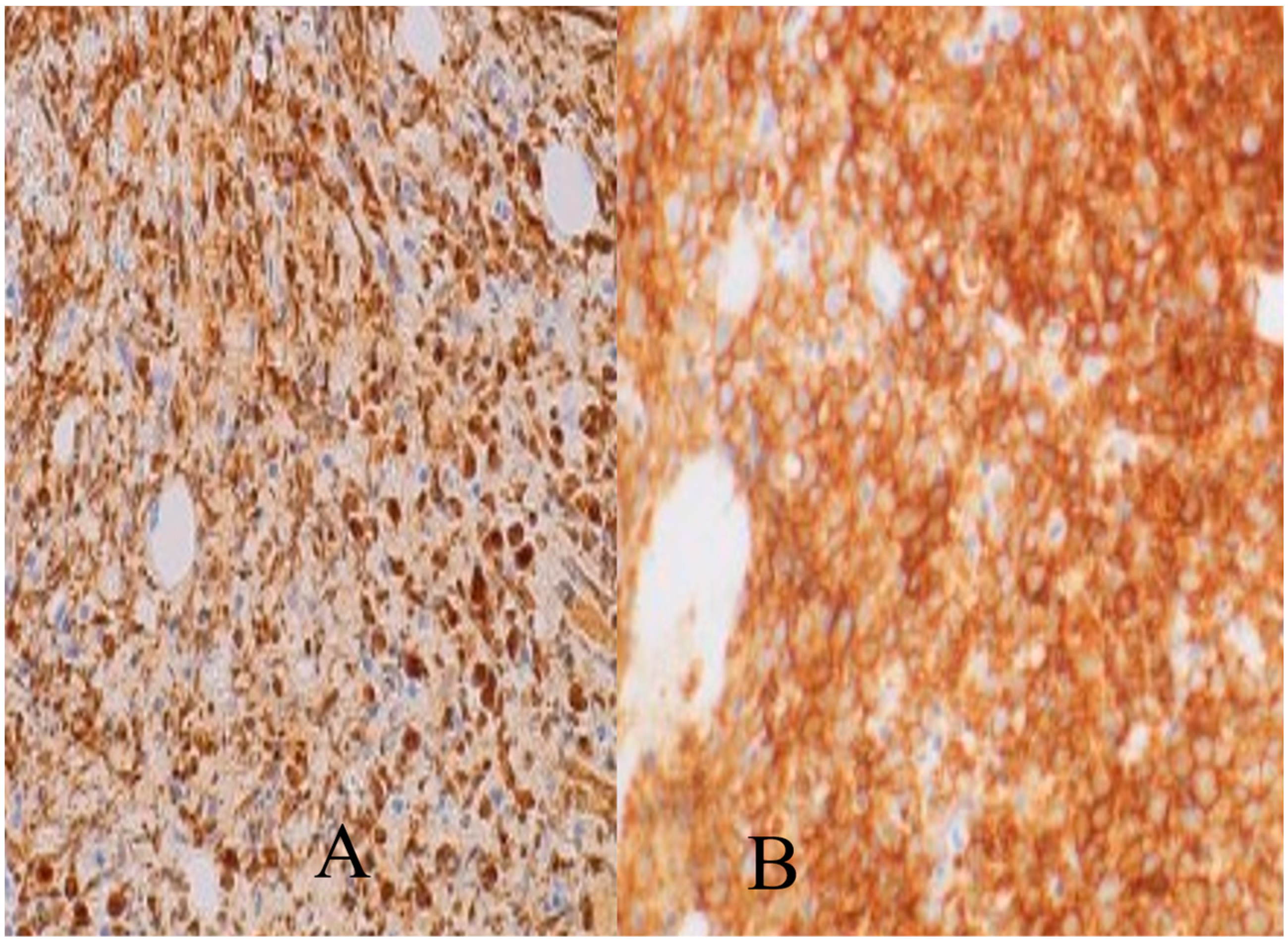 Hematolrep 15 00061 g002 Hematolrep 15 00061 g002