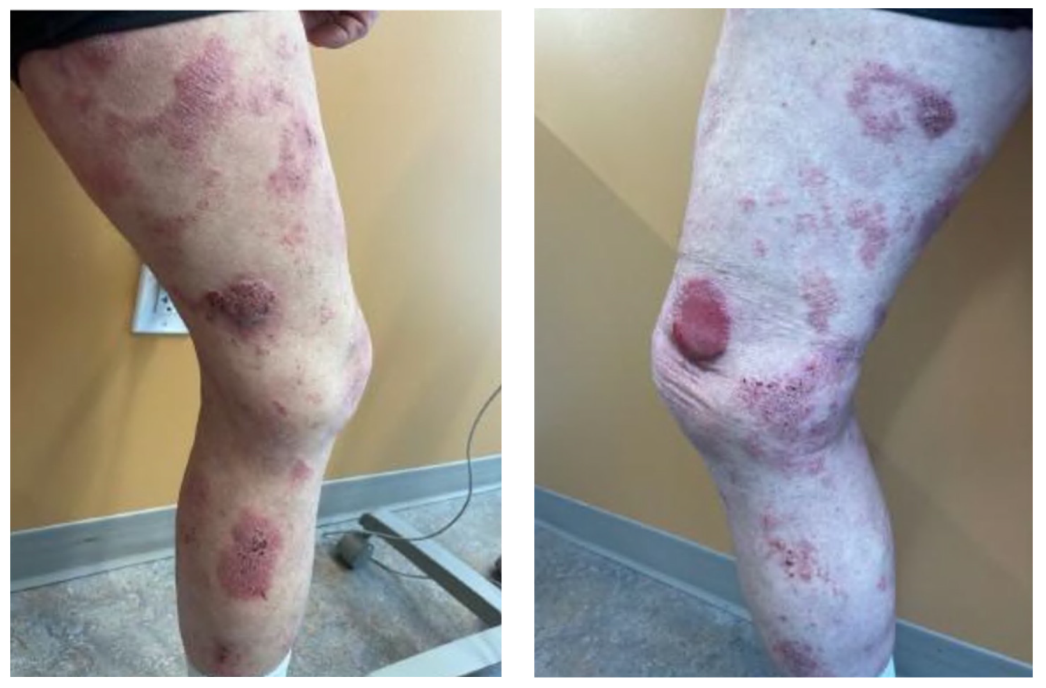 Hematolrep 16 00002 g001