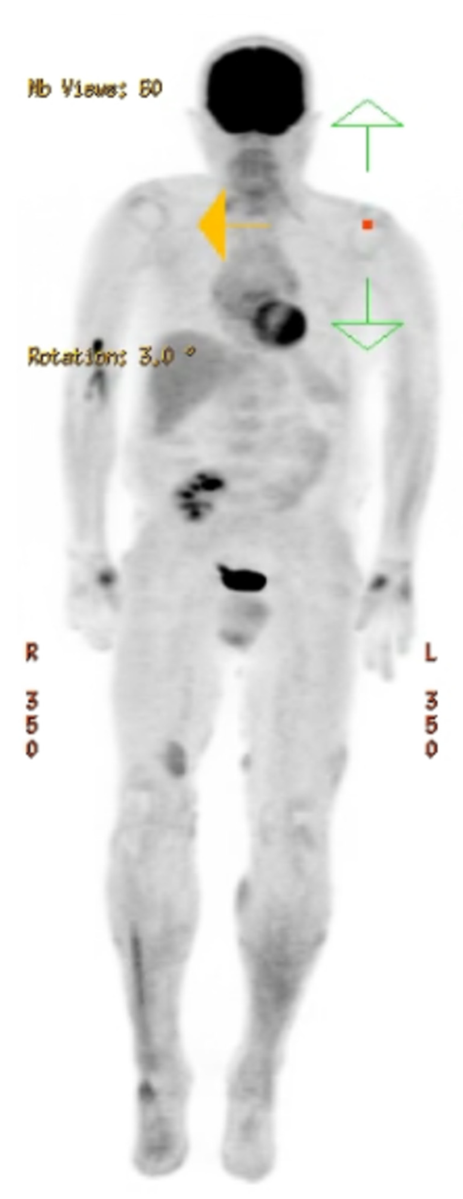 Hematolrep 16 00002 g003