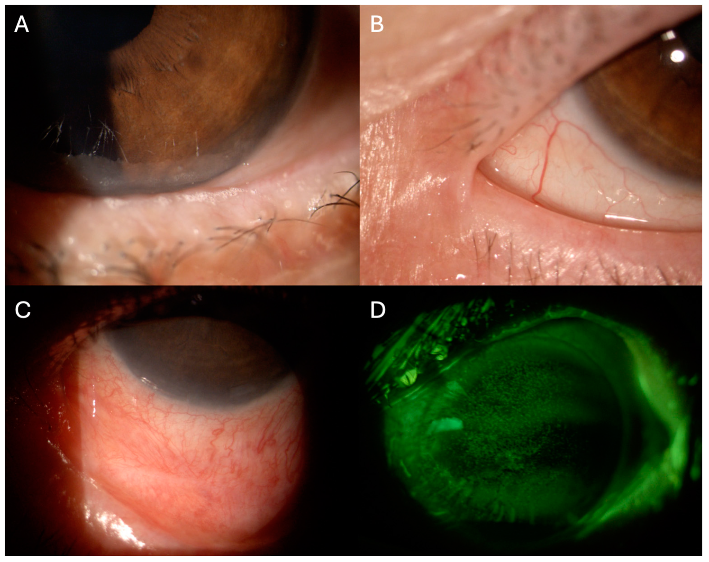 Hematolrep 16 00020 g001